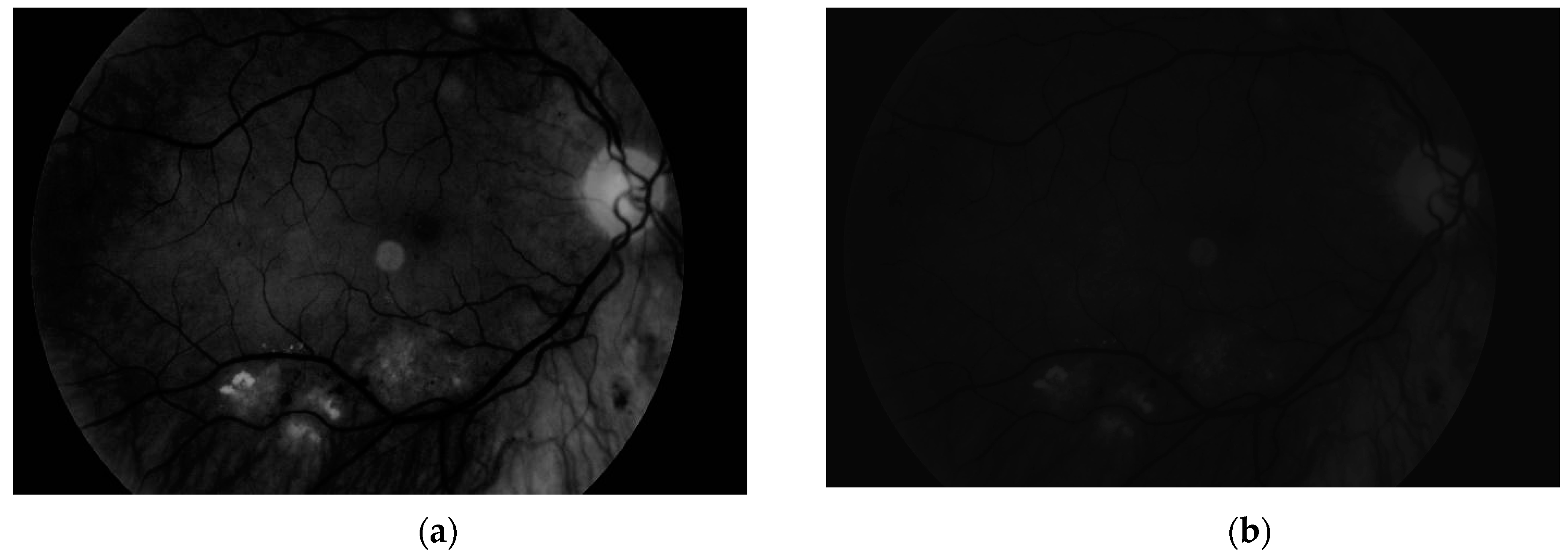 Sensors 19 00695 g008 550