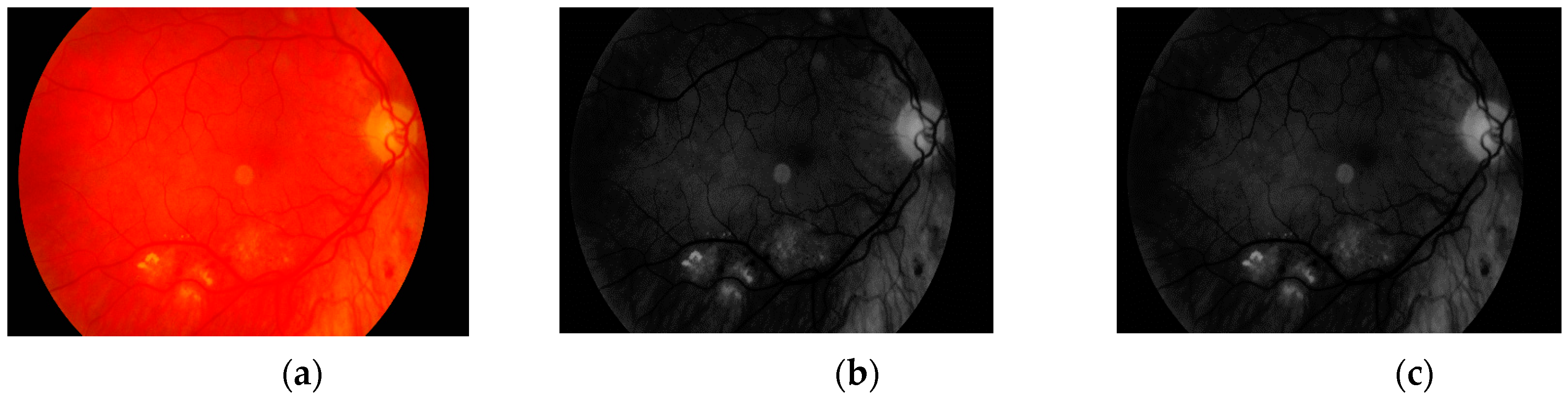 Sensors 19 00695 g010 550