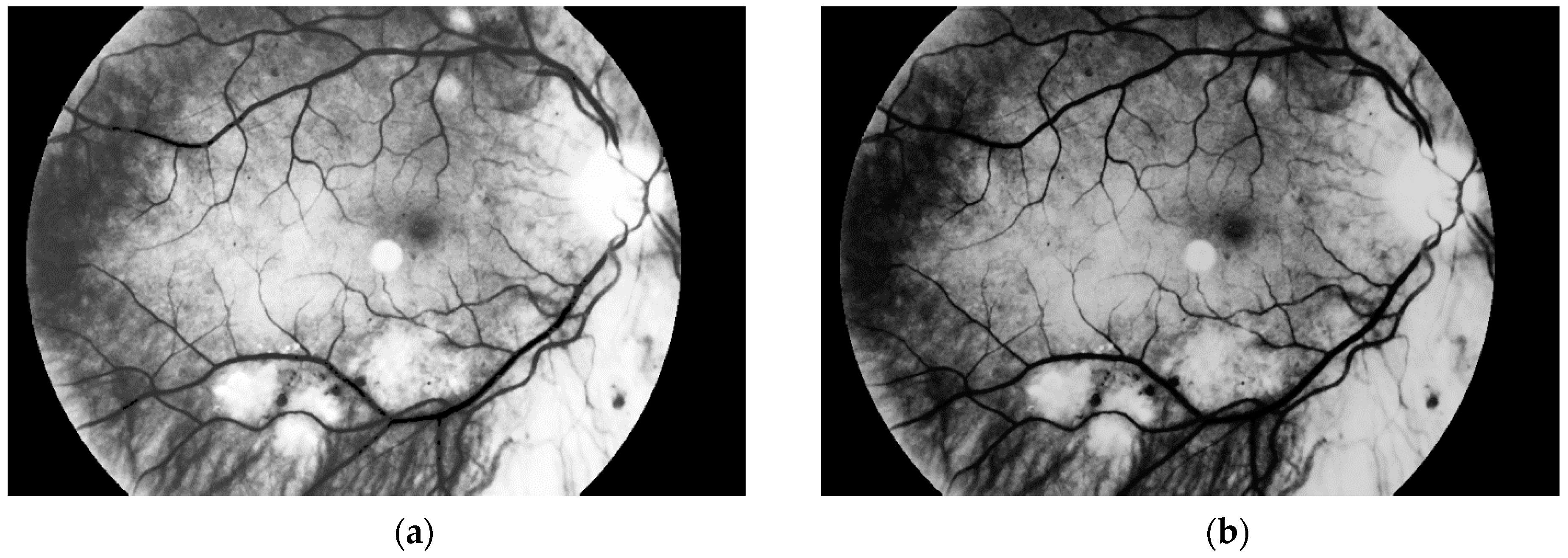 Sensors 19 00695 g011 550