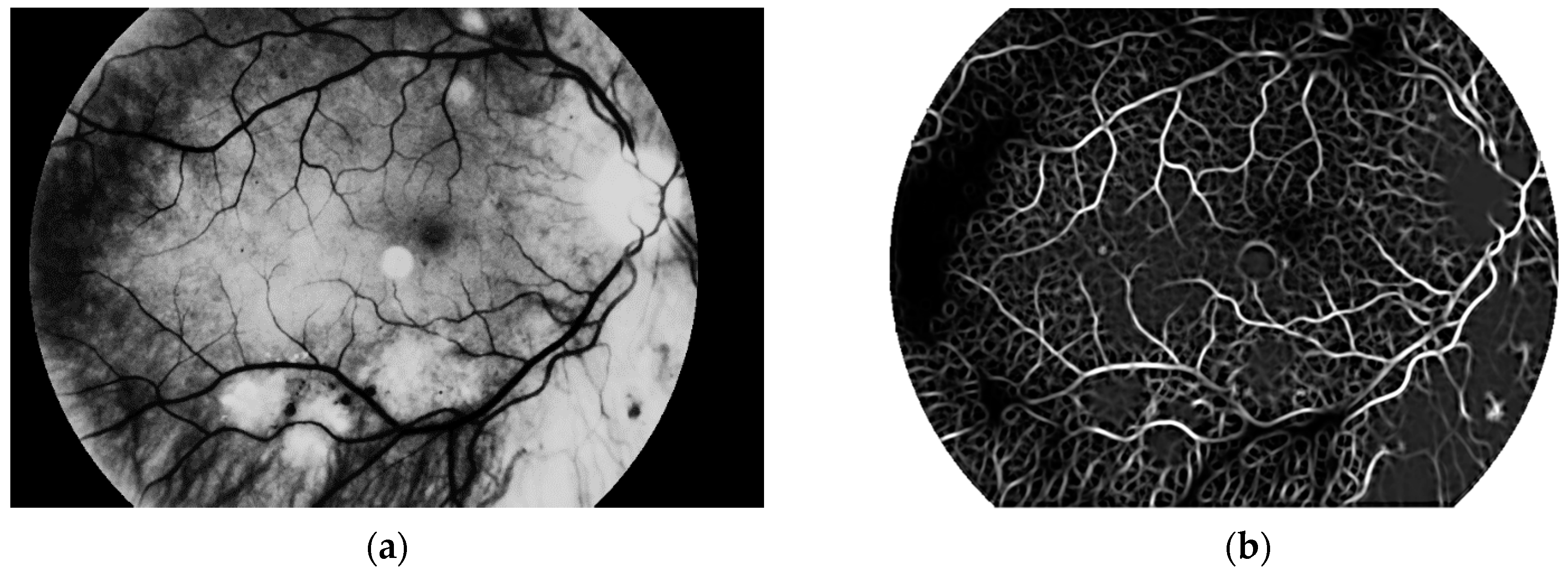 Sensors 19 00695 g012 550