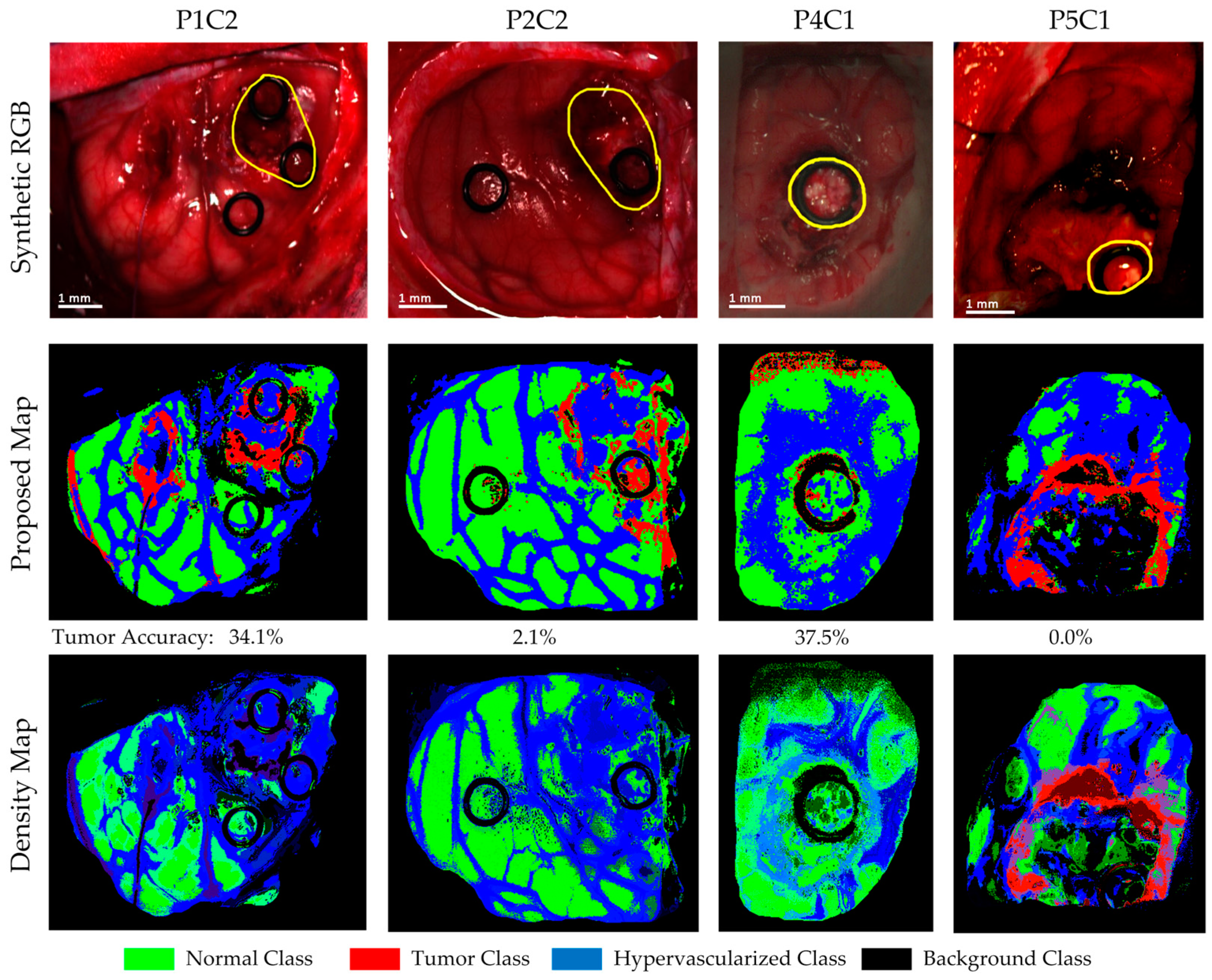 Sensors 19 00920 g011
