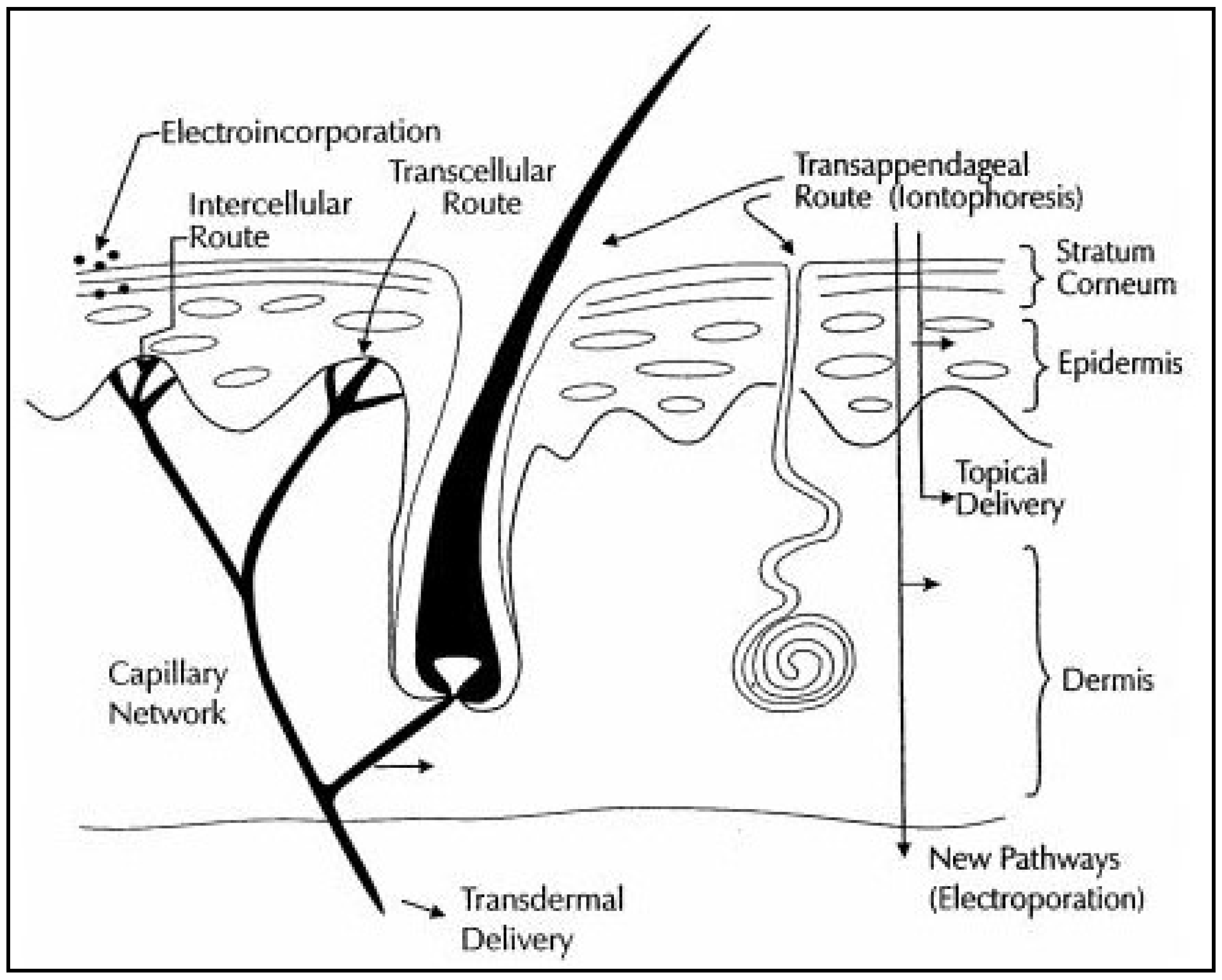 Example of transdermal electric muscle stimulation by means of a