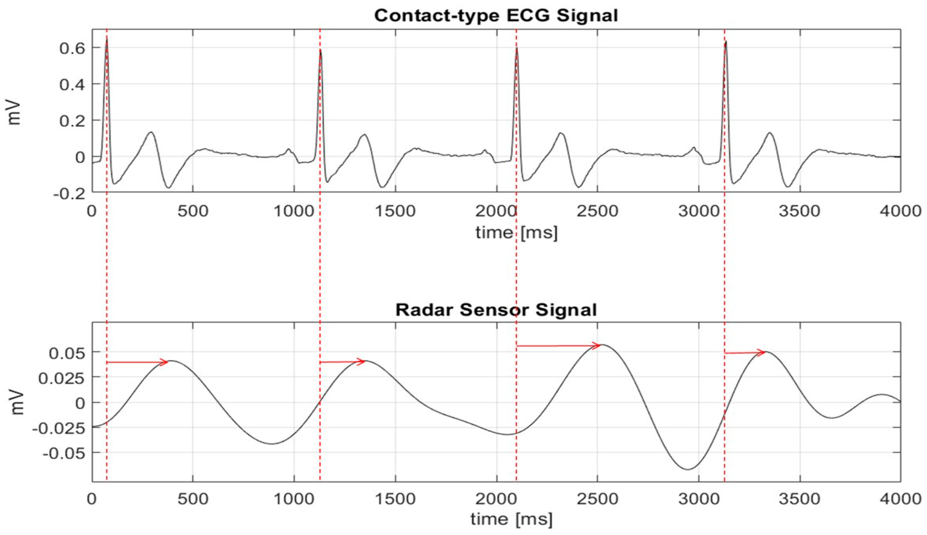 Simple Ecg Workout Exercises In Arrhythmia Interpretation 7Th Edition Pdf for Women