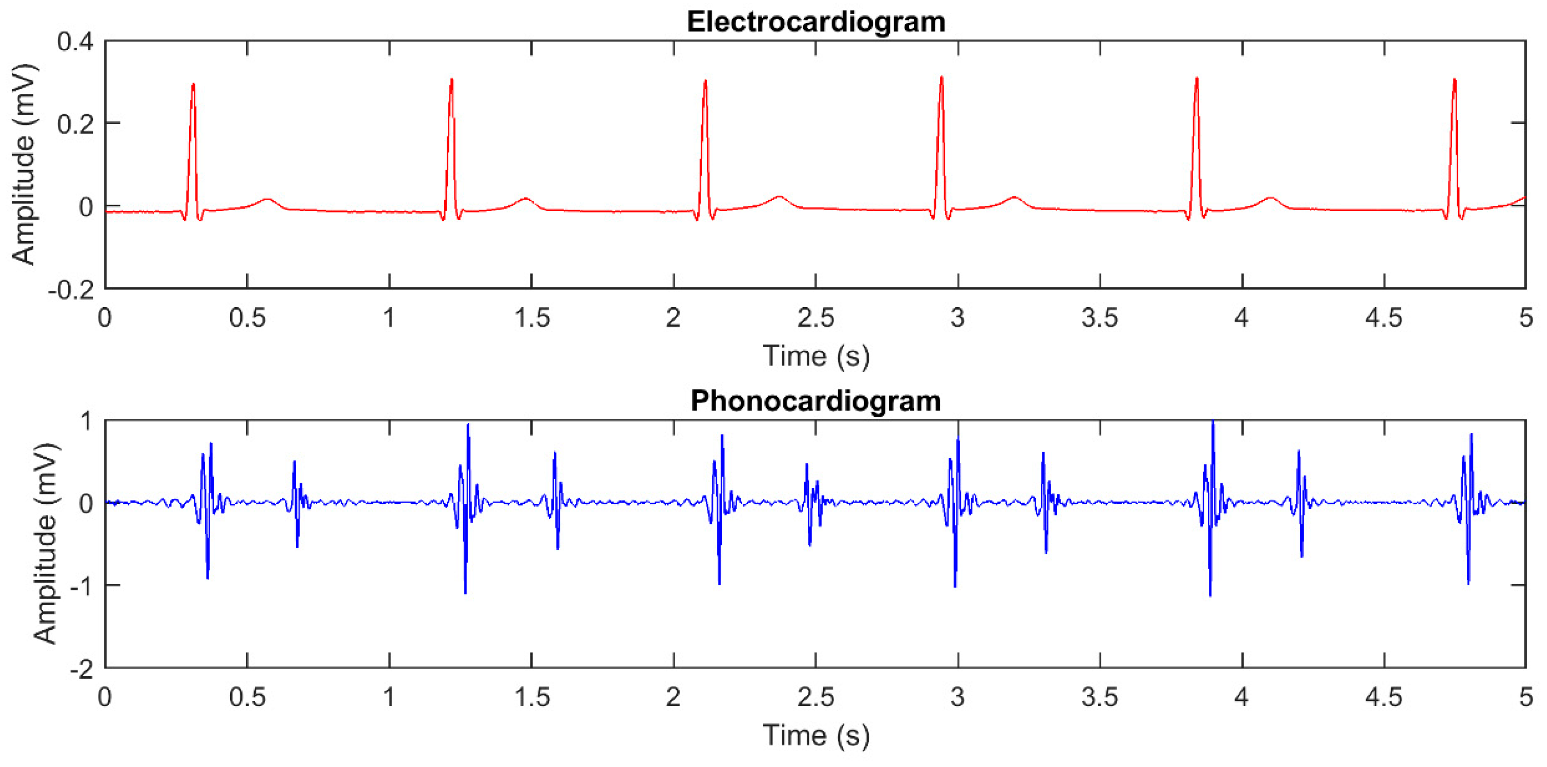heartbeat sound heartbeat sound