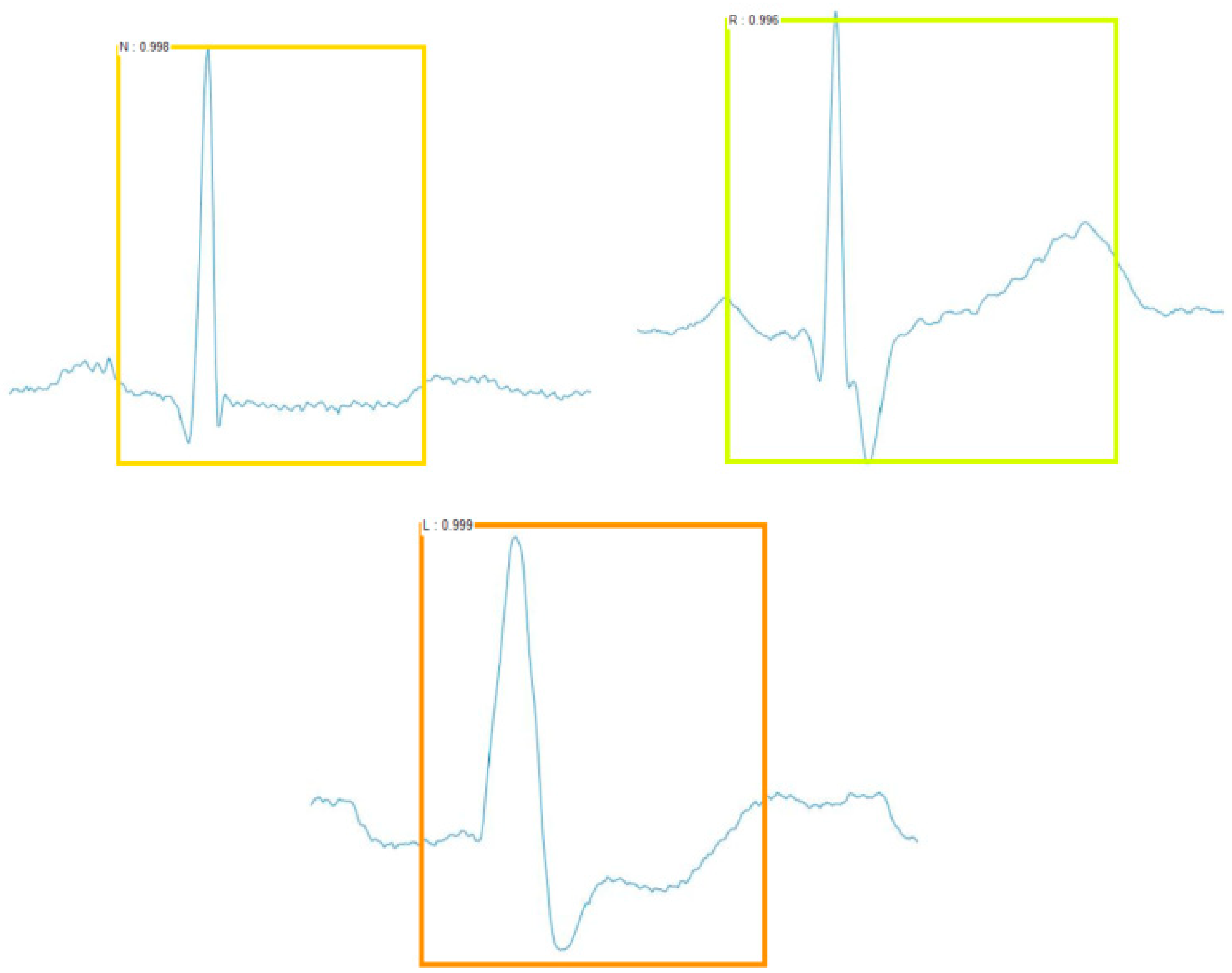 Sensors 19 02558 g012