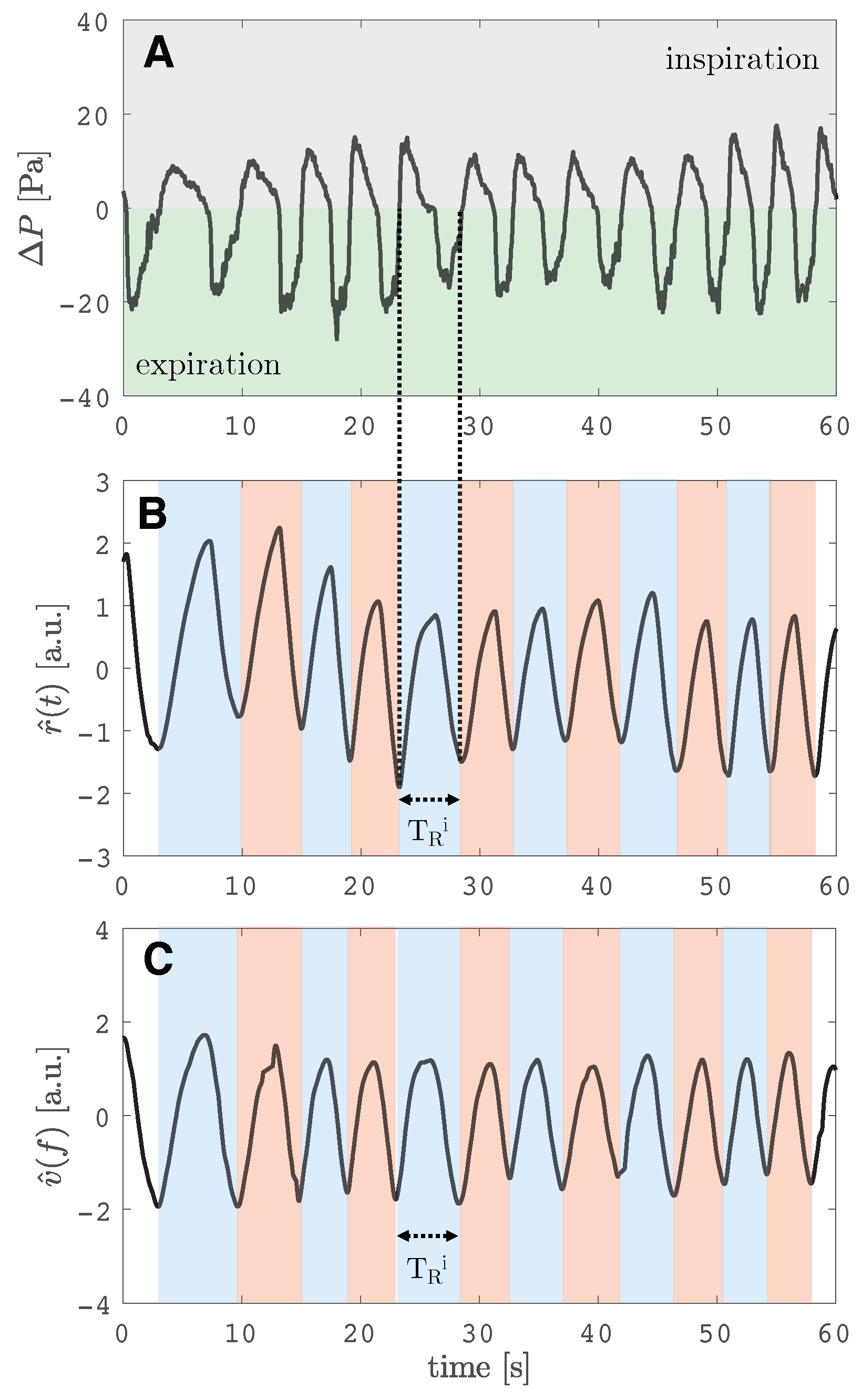 Sensors Free FullText NonContact Monitoring of Breathing Pattern