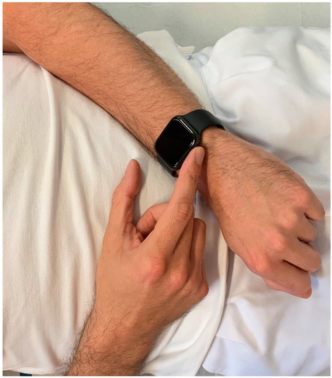 smartwatch ekg sensor