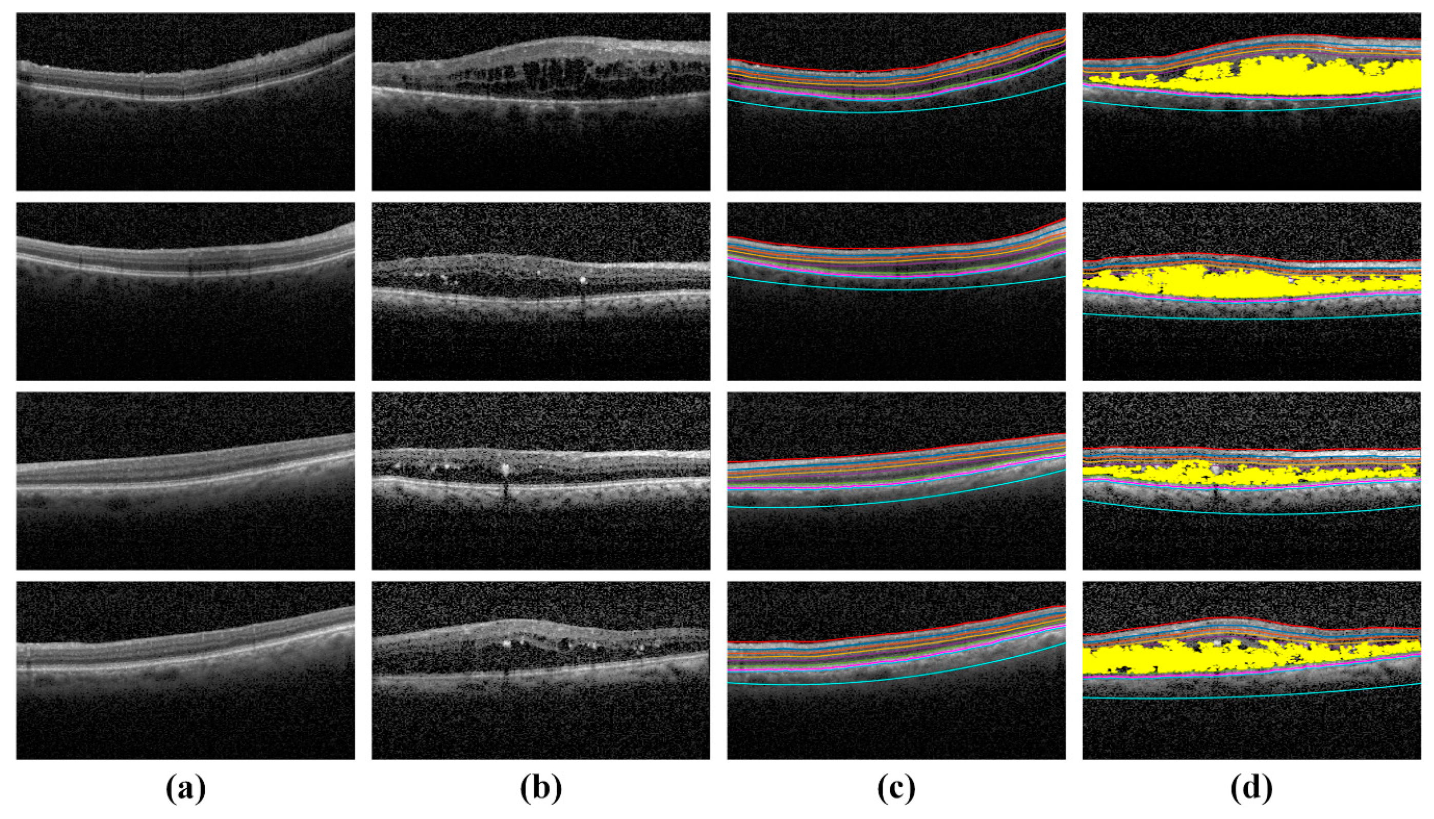 Sensors 19 02970 g013