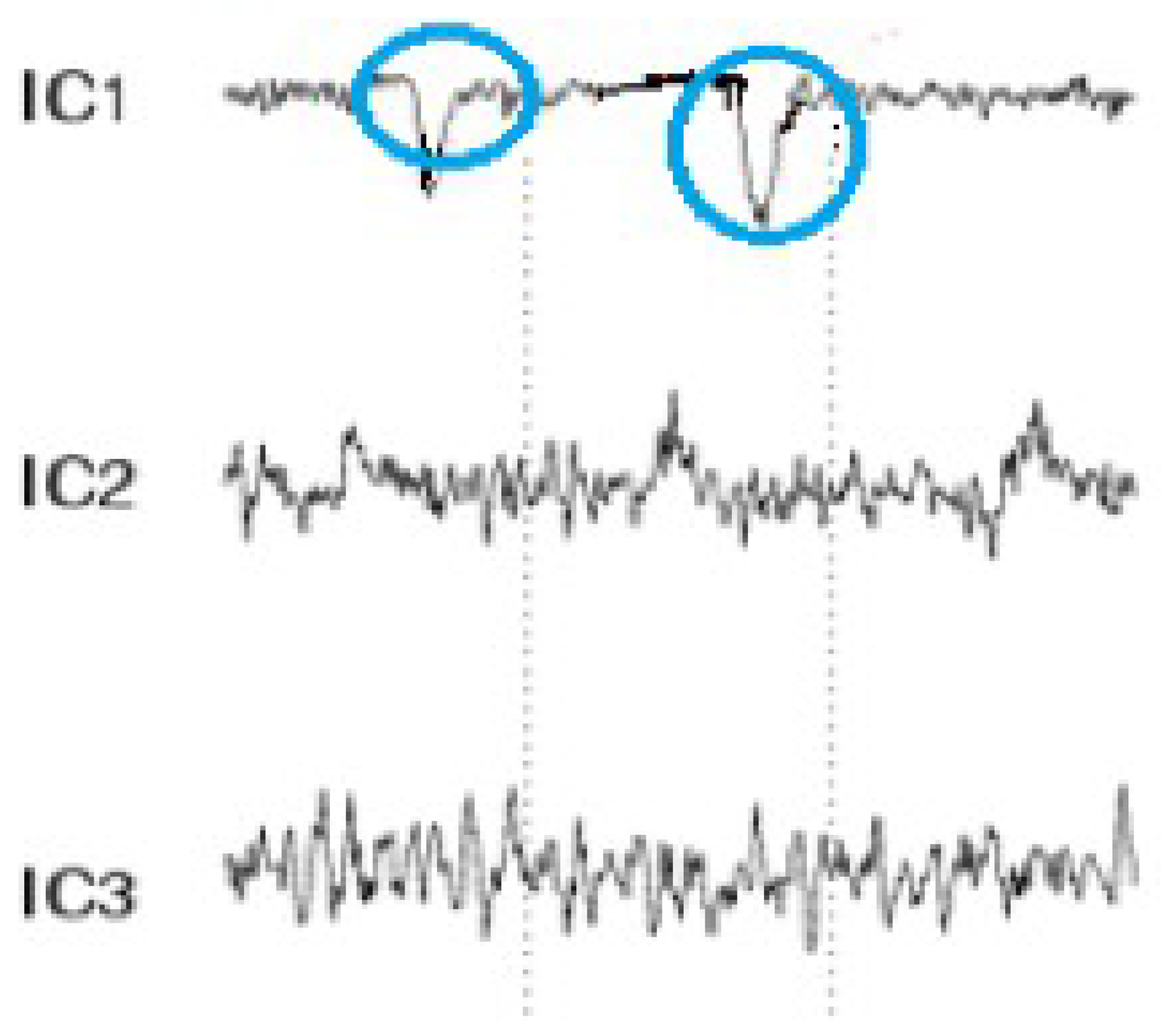 Sensors 19 03042 g004 550