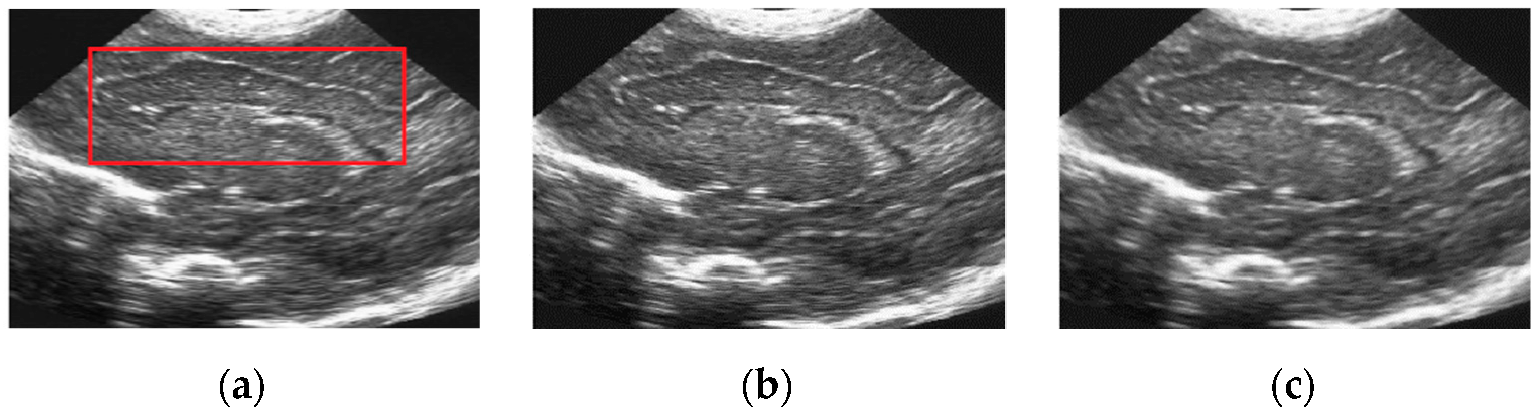 Sensors 19 03164 g010a