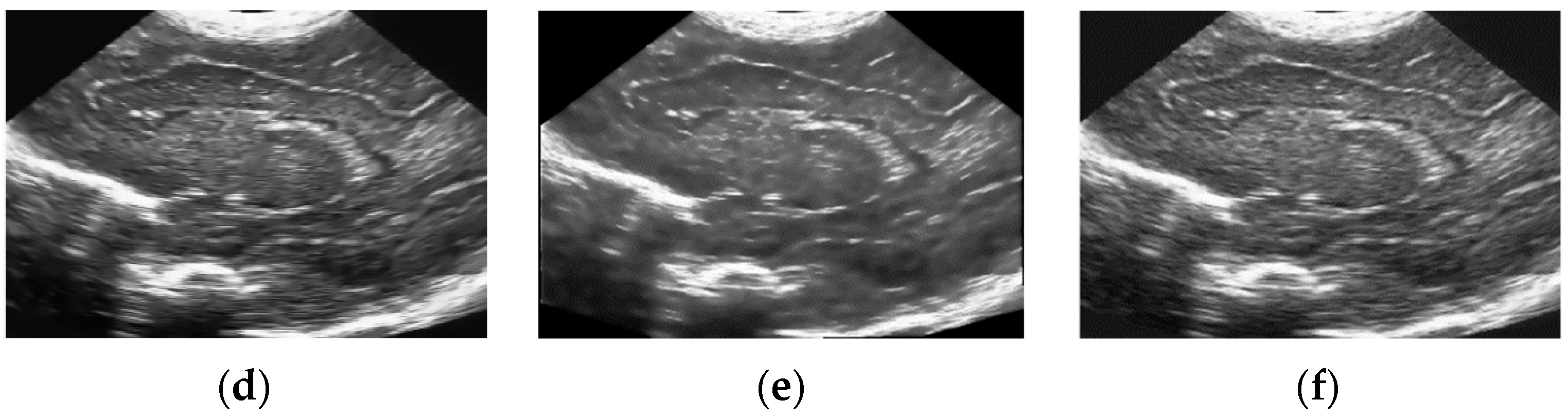 Sensors 19 03164 g010b