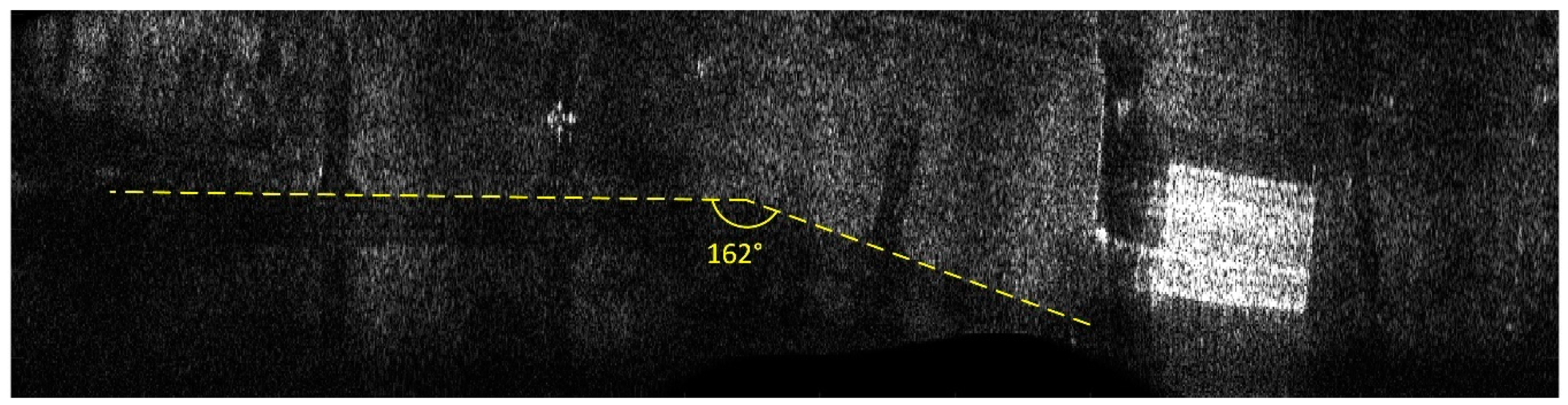 Sensors 19 03895 g016 550