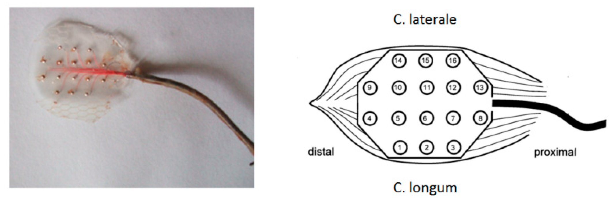 Sensors 19 04477 g003 550