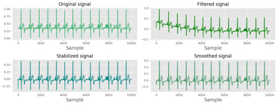 An Ensemble Learning Approach for Electrocardiogram Sensor Based Human ...