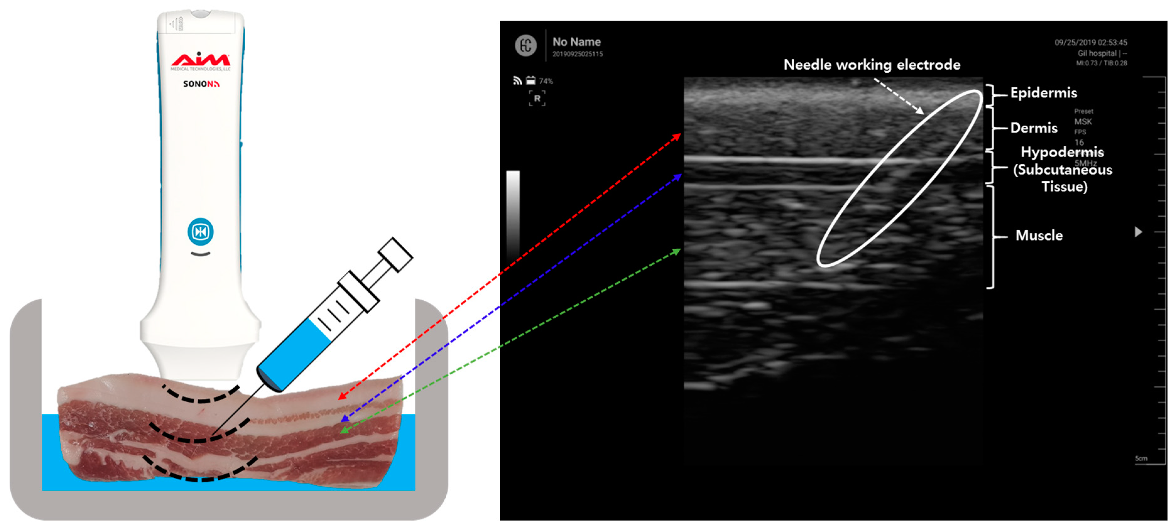 Sensors 19 04614 g003