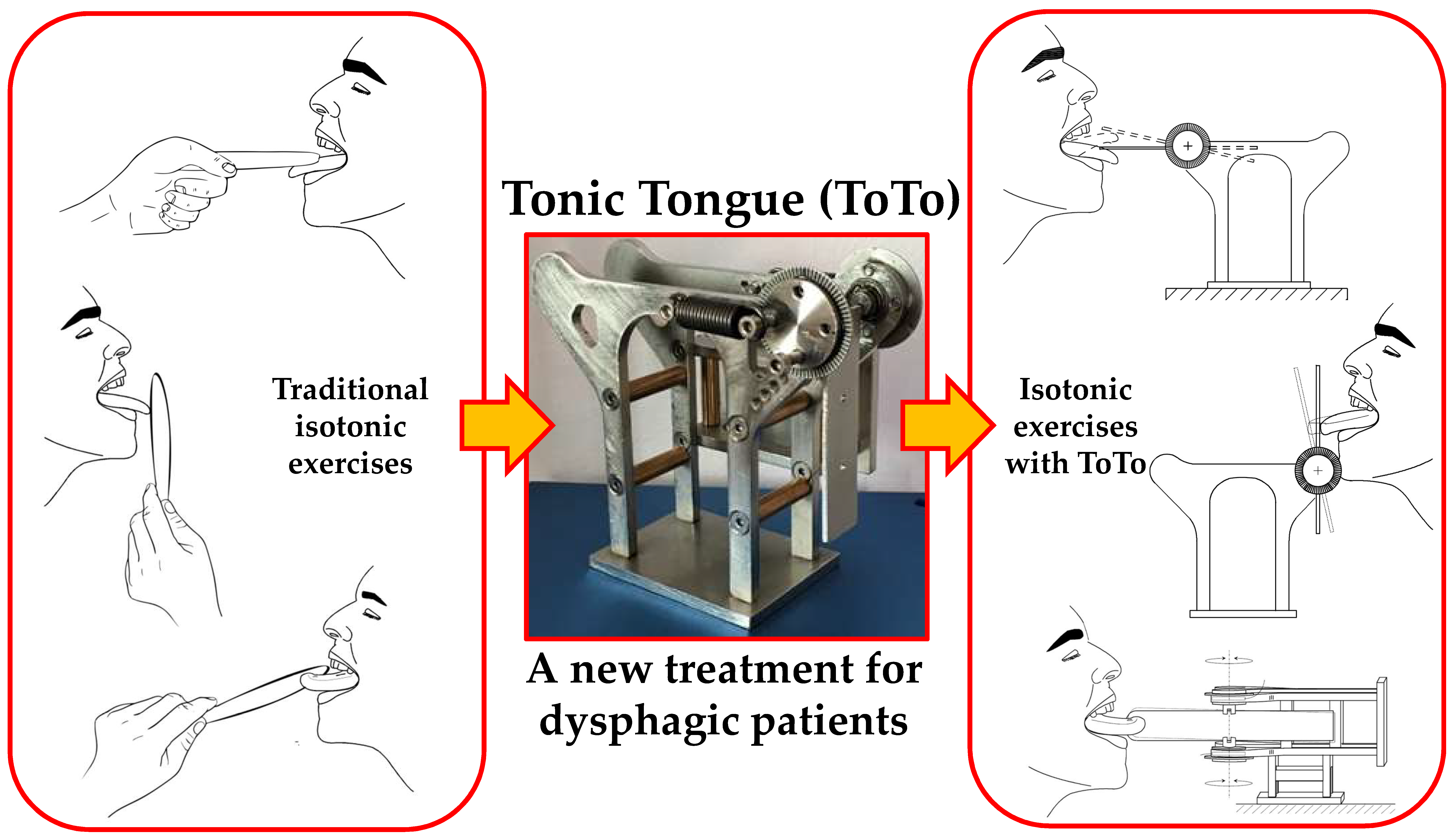 Sensors Free FullText Tongue Rehabilitation Device for Dysphagic
