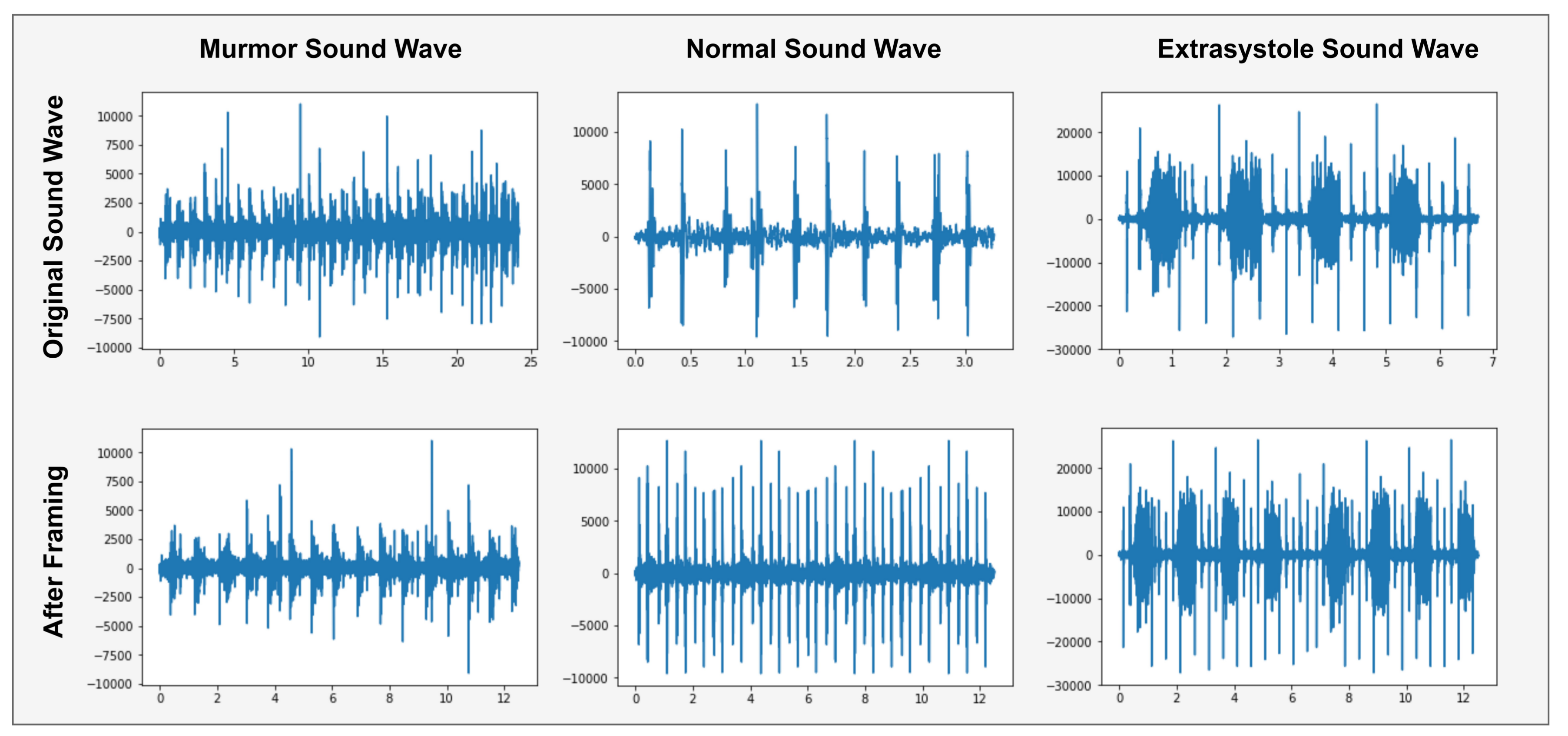 Sensors Free FullText Heartbeat Sound Signal Classification Using