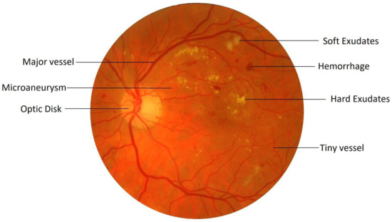 Solution manual for digital image processing by jayaraman pdf download Solution manual for digital image processing by jayaraman pdf download