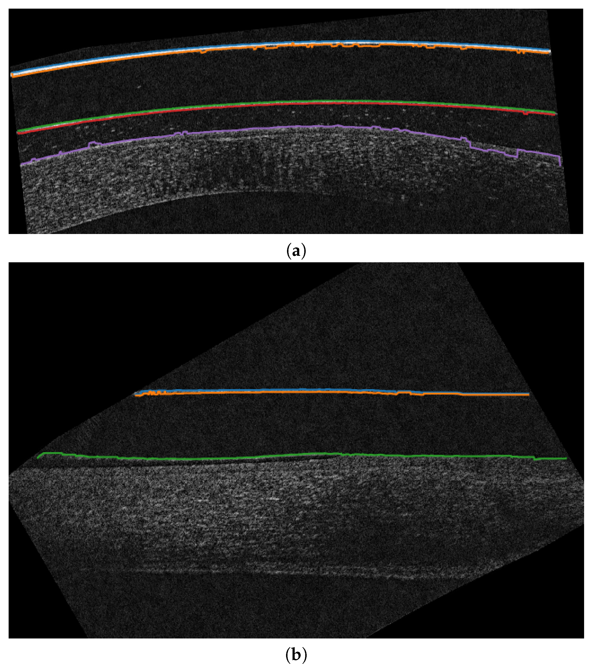 Sensors 19 05087 g007