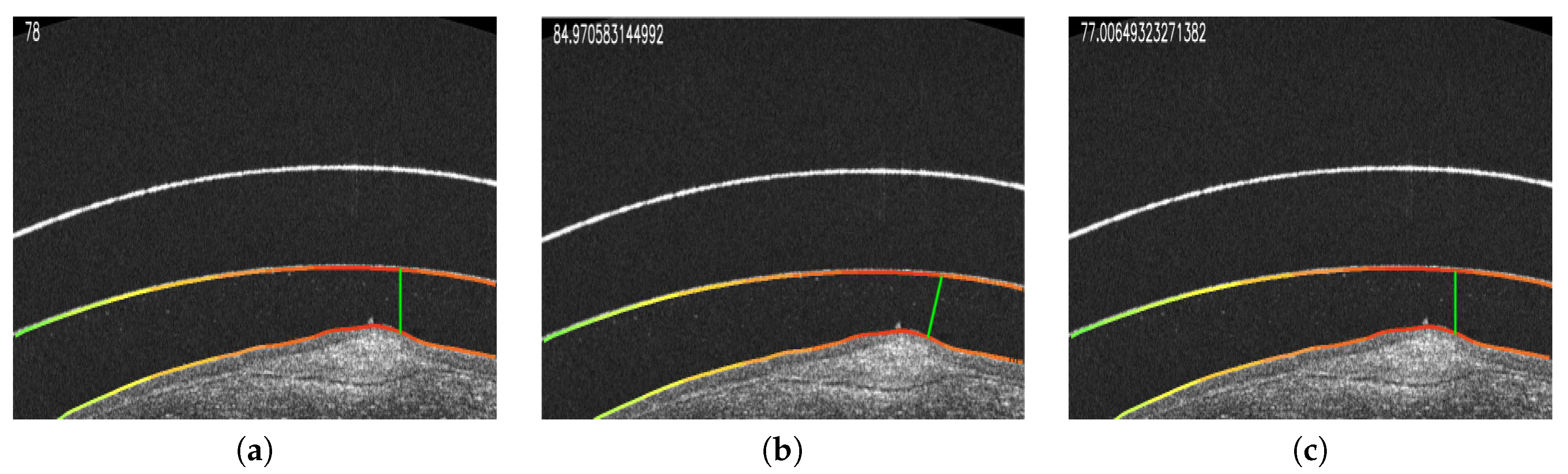 Sensors 19 05087 g013
