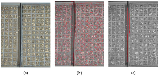 Normative 3d Opto Electronic Stereo Photogrammetric Posture And Spine Morphology Data In Young Healthy Adult Population