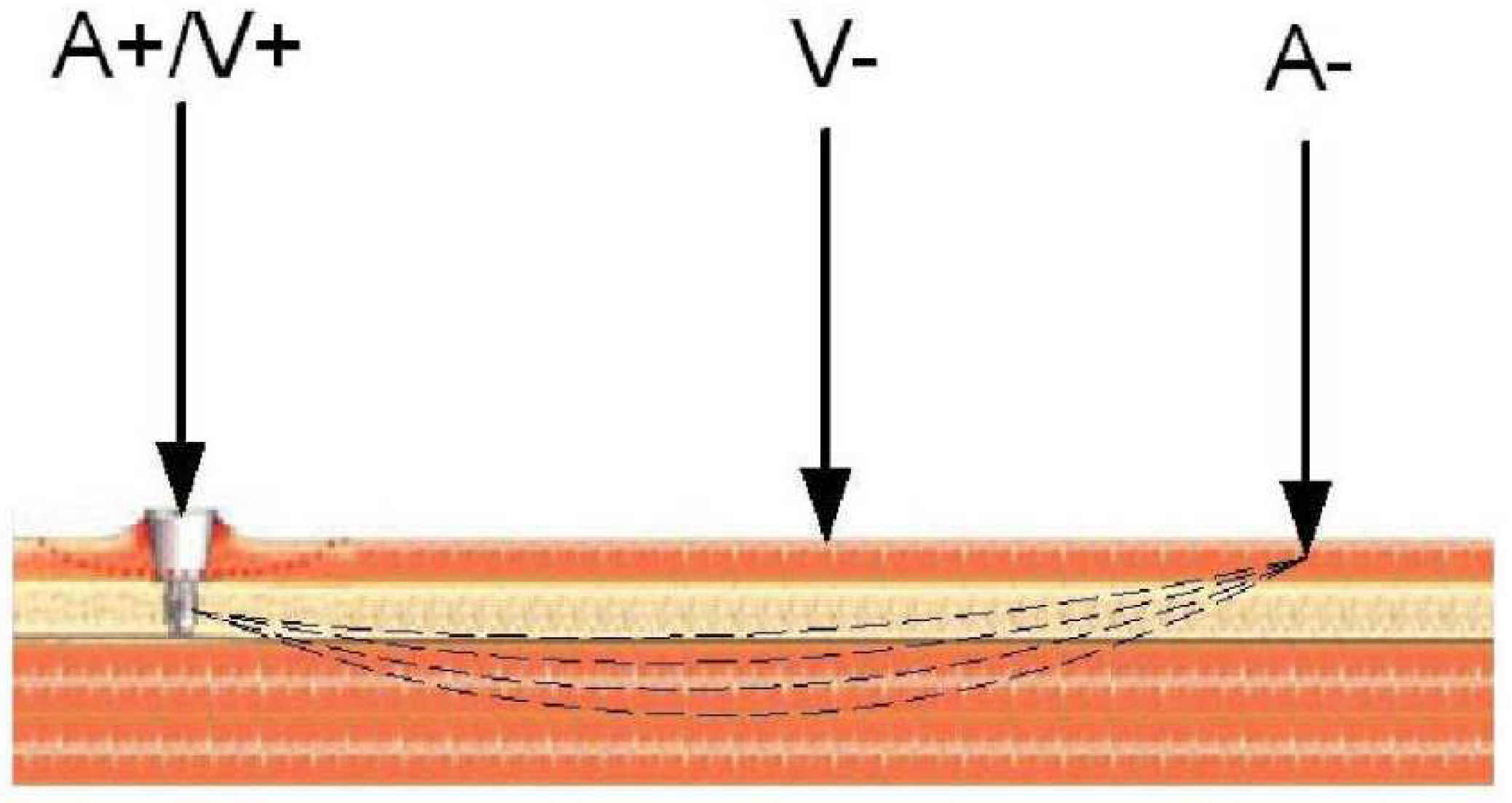 Sensors 20 00104 g014