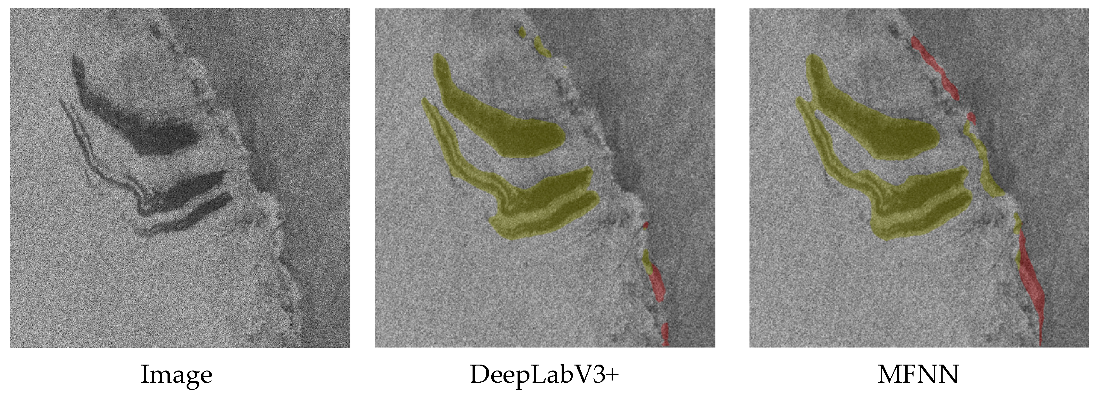 Sensors 20 00210 g011 Sensors 20 00210 g011