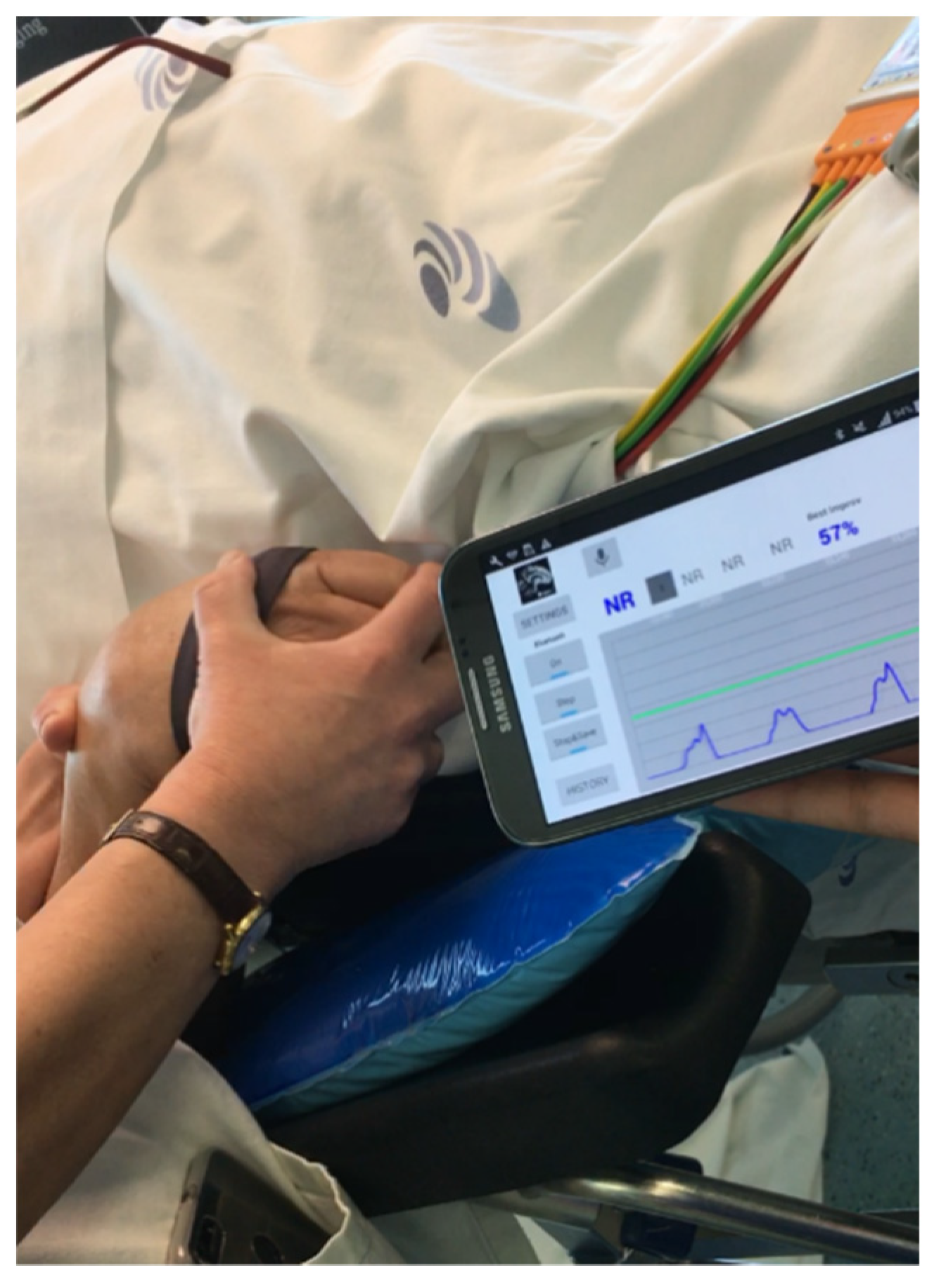 Sensors 20 00331 g005