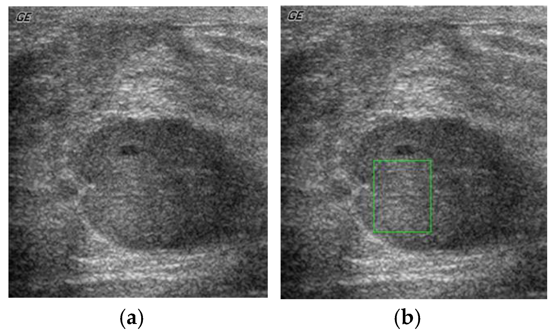 Sensors 20 00432 g002