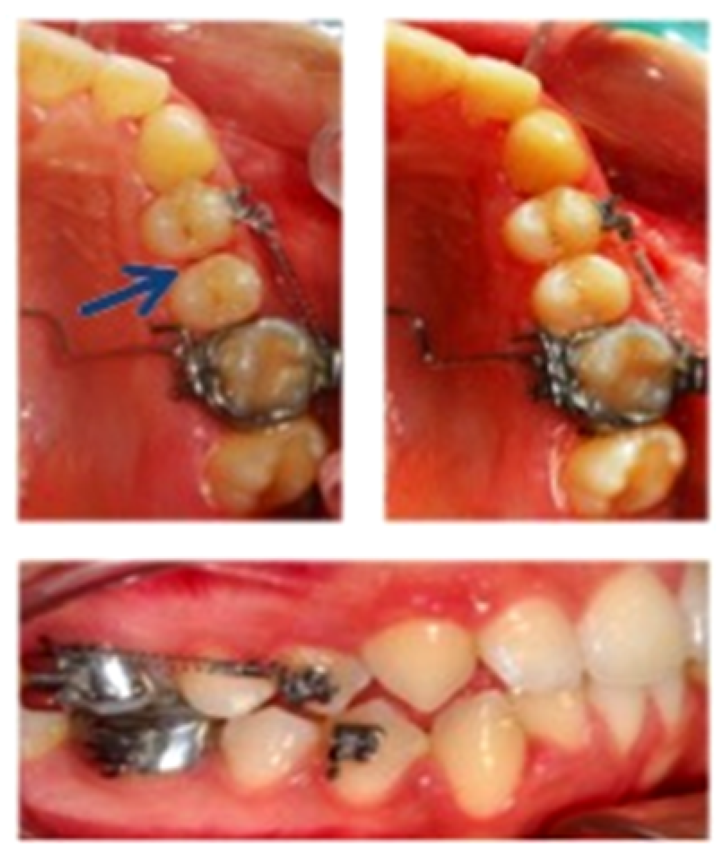 Sensors 20 00497 g002 Sensors 20 00497 g002