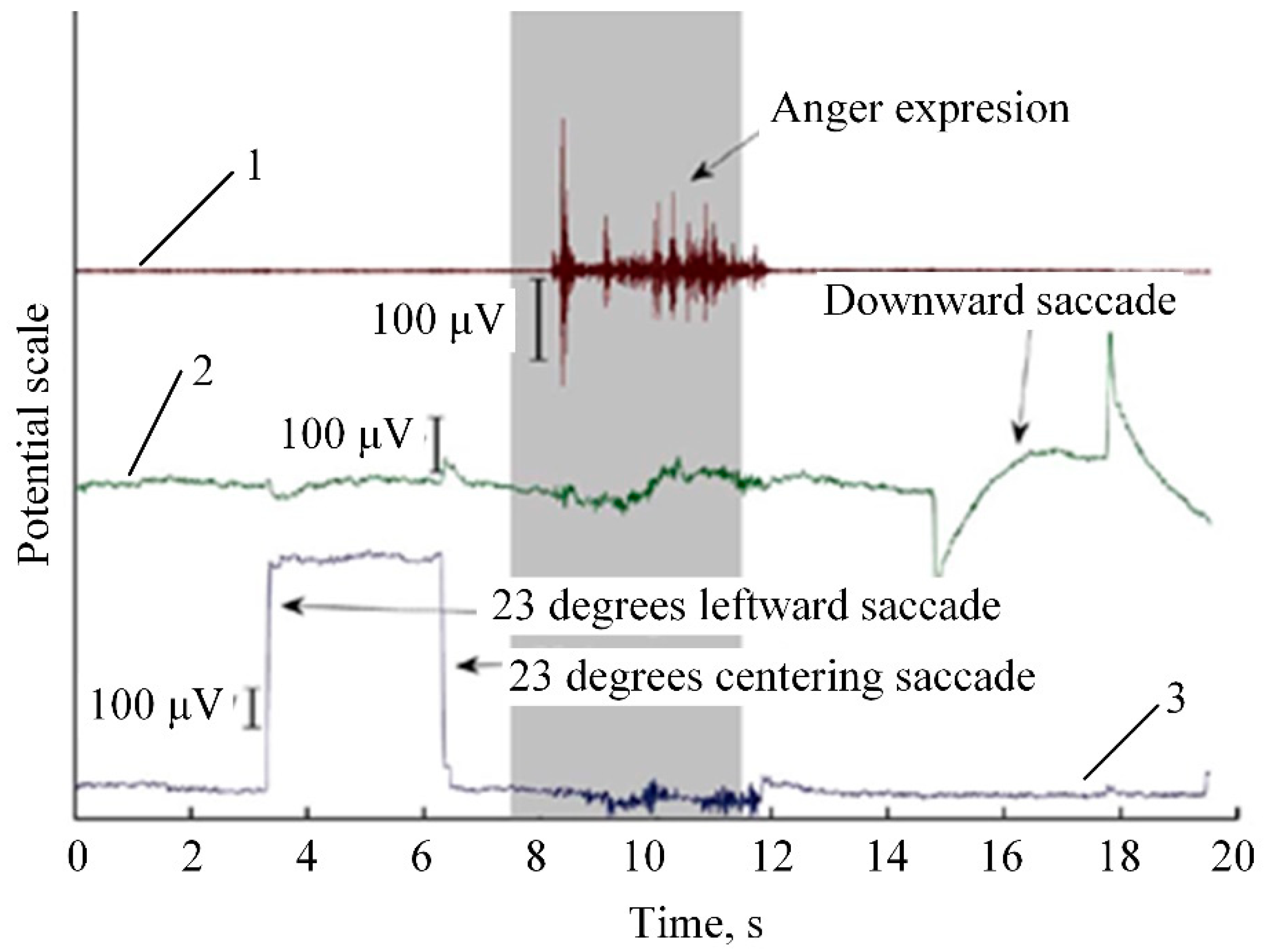 Sensors 20 00592 g014