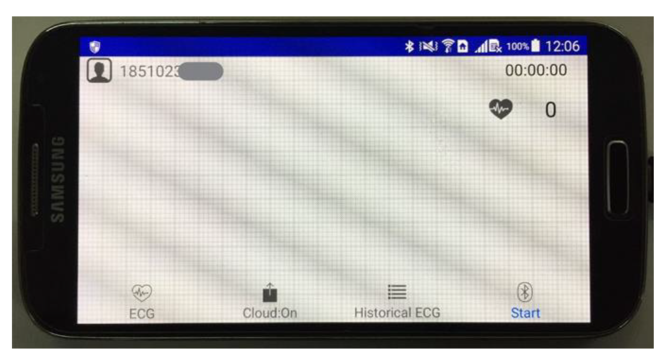 Sensors 20 00606 g005