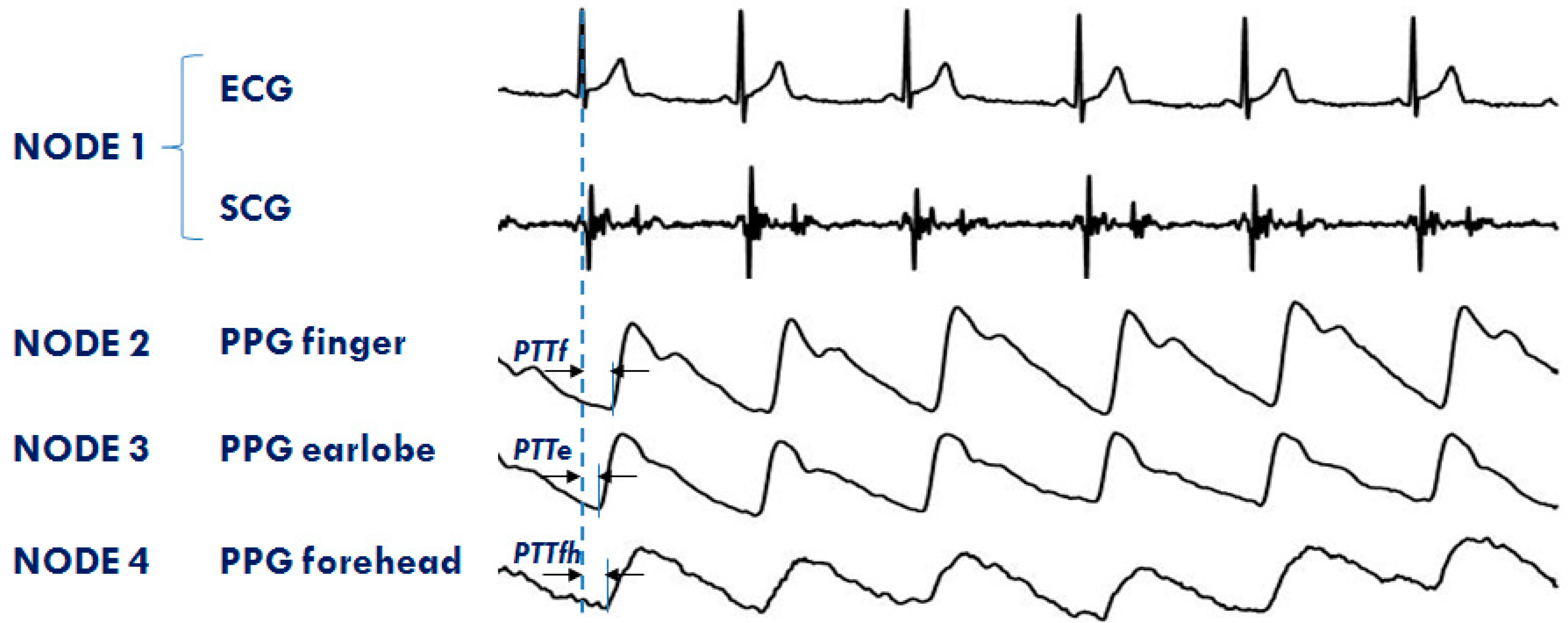 Sensors 20 00680 g011