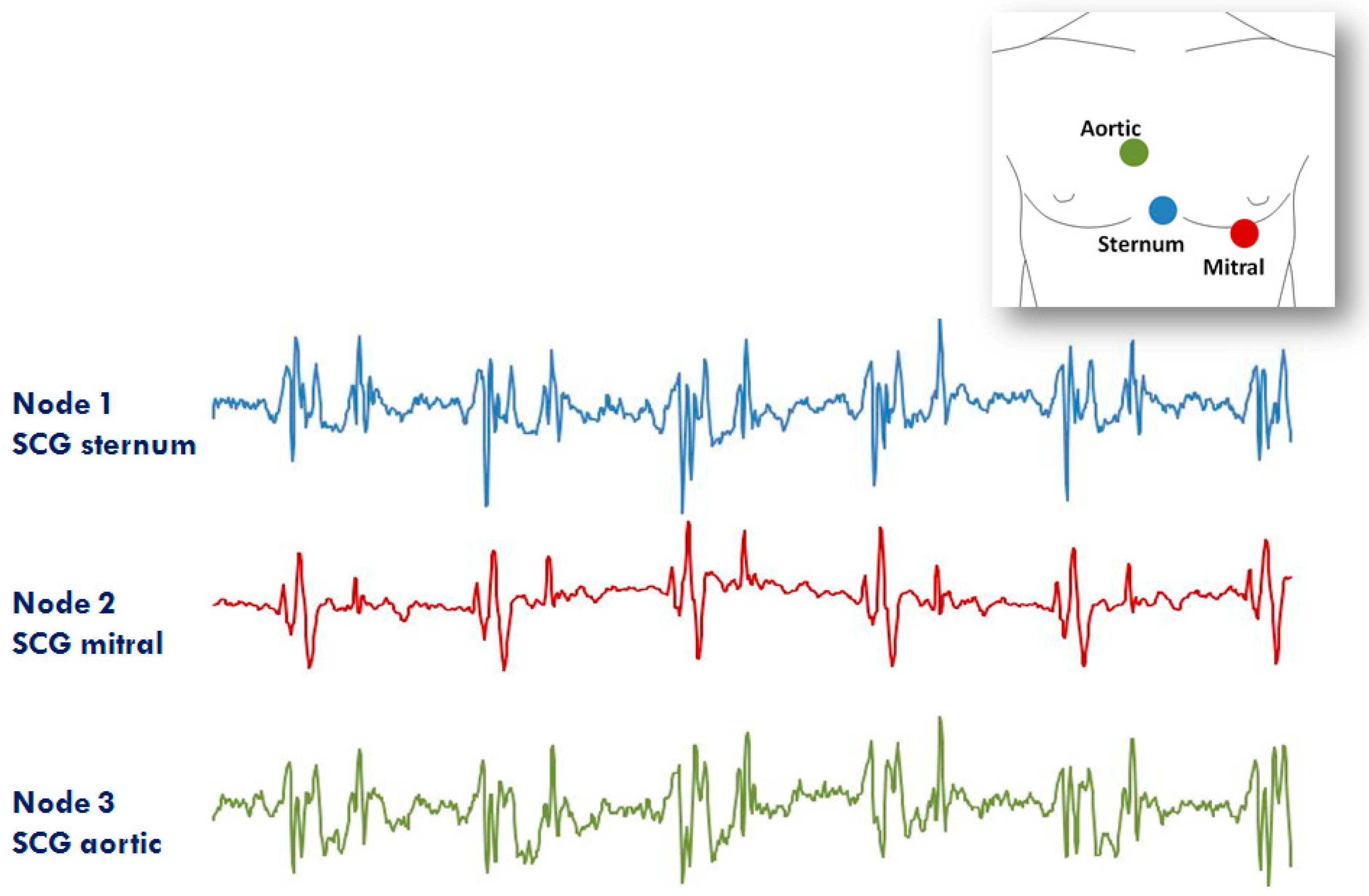 Sensors 20 00680 g012