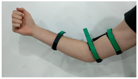 Sensors 20 00858 g001 550
