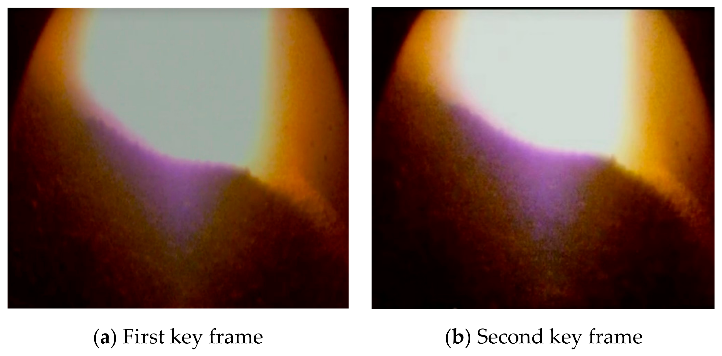 Sensors 20 00869 g011