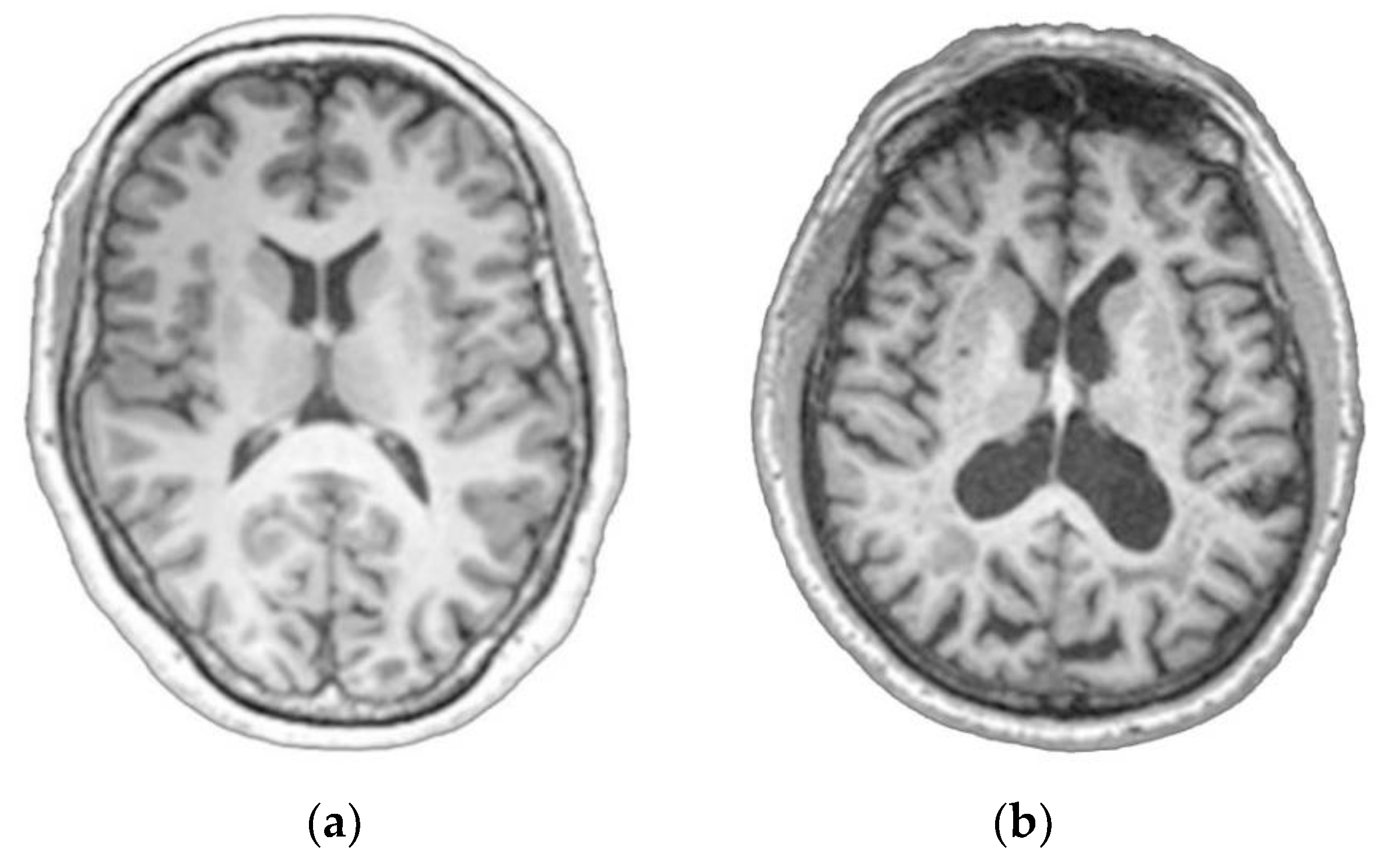 Sensors 20 00941 g001