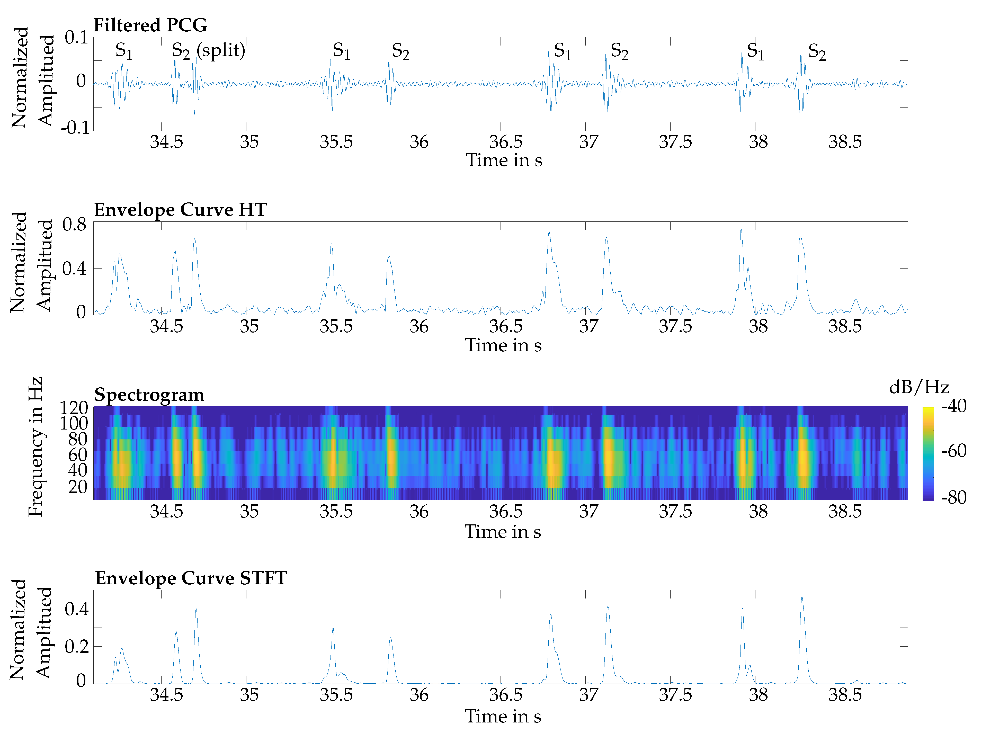 Sensors 20 00972 g004