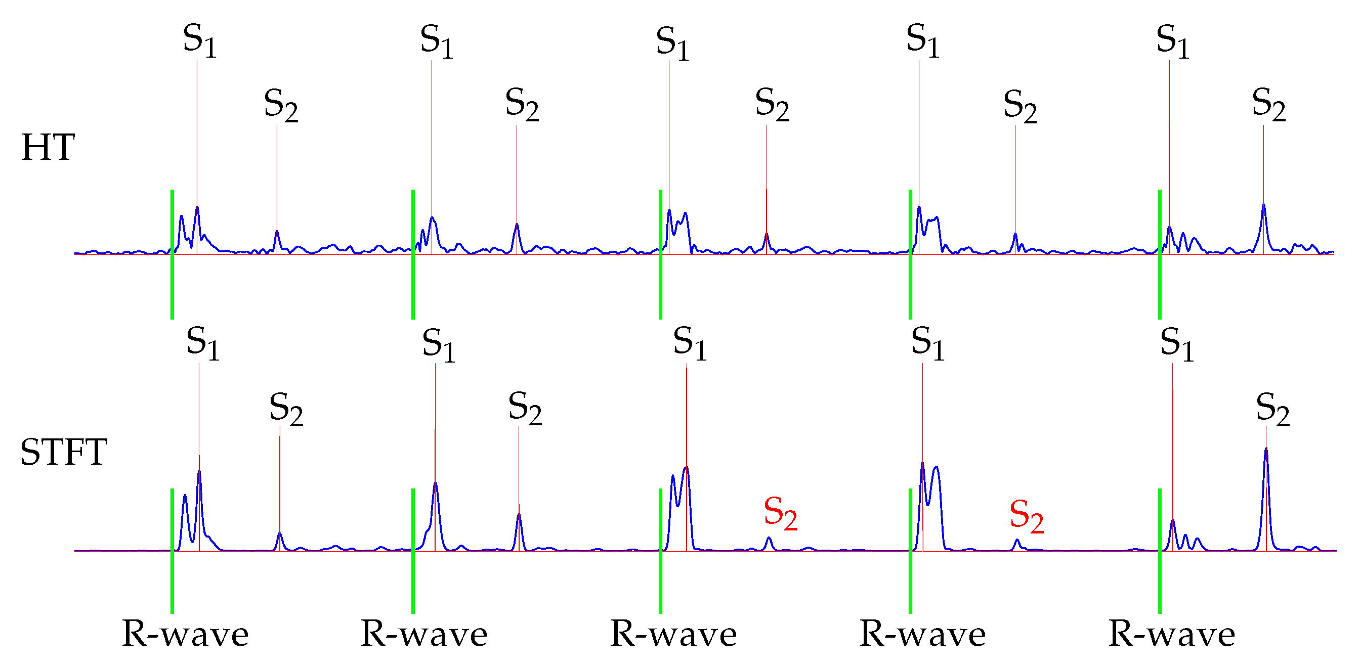 Sensors 20 00972 g010