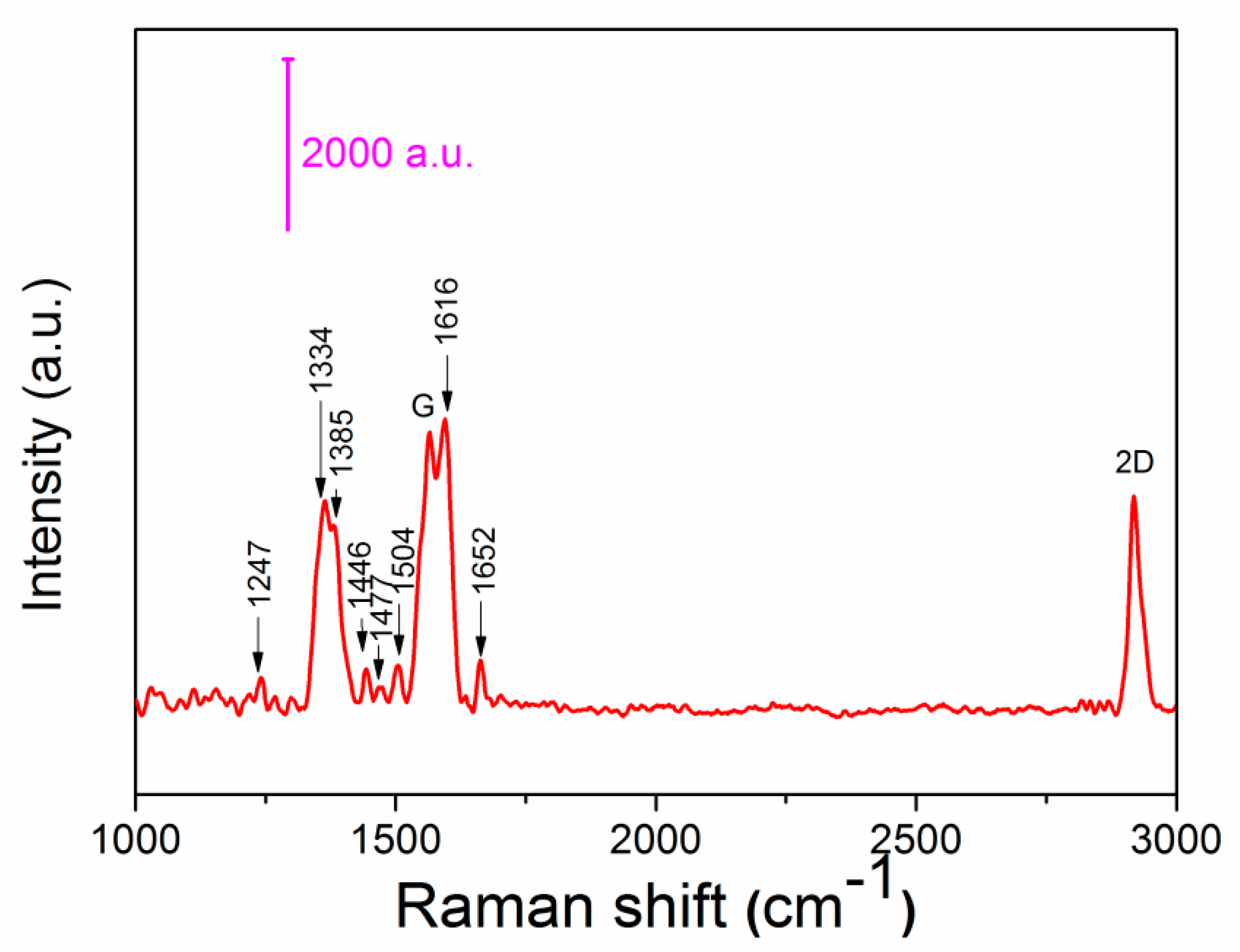 Sensors 20 00991 g007 Sensors 20 00991 g007