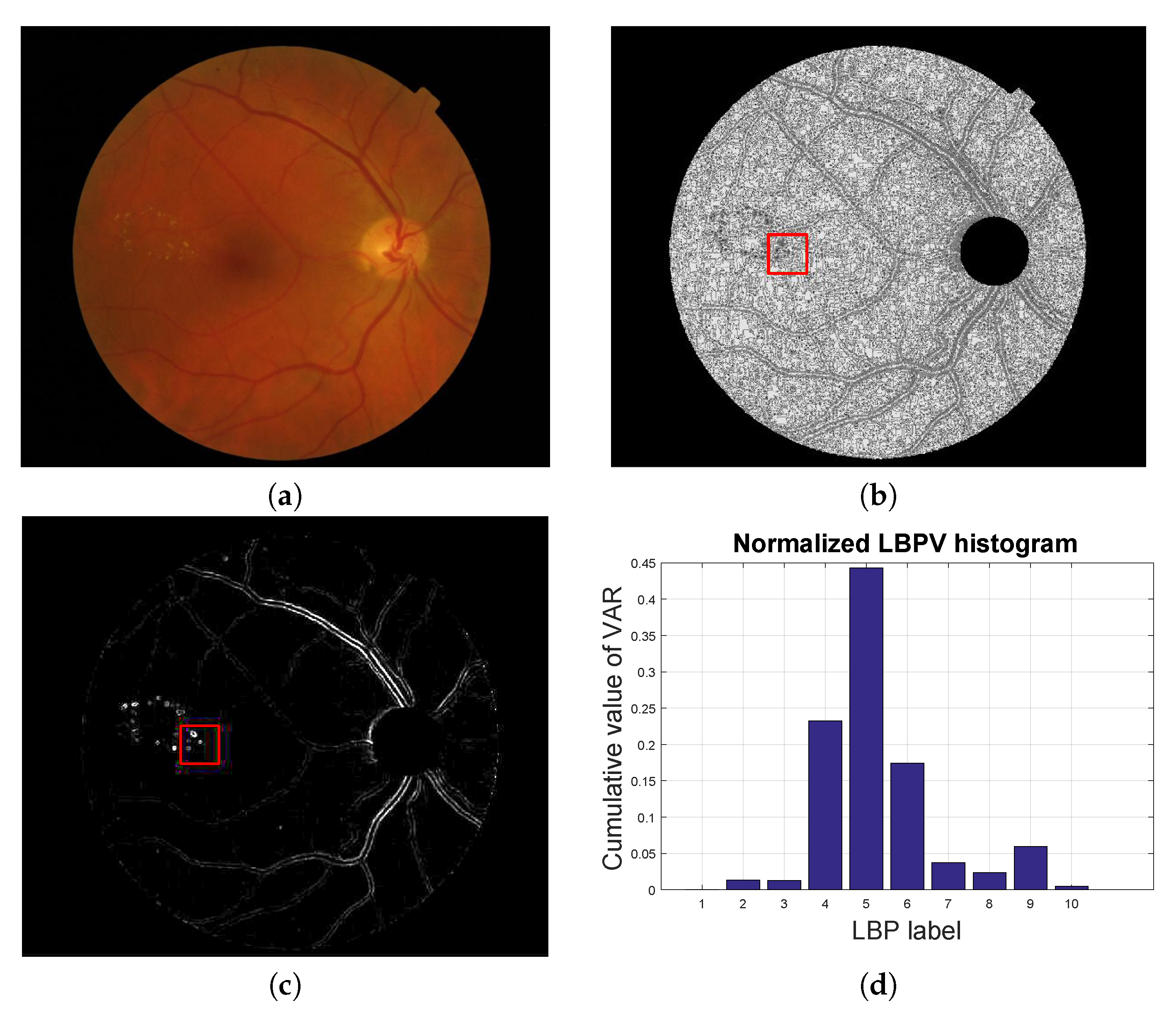 Sensors 20 01005 g004