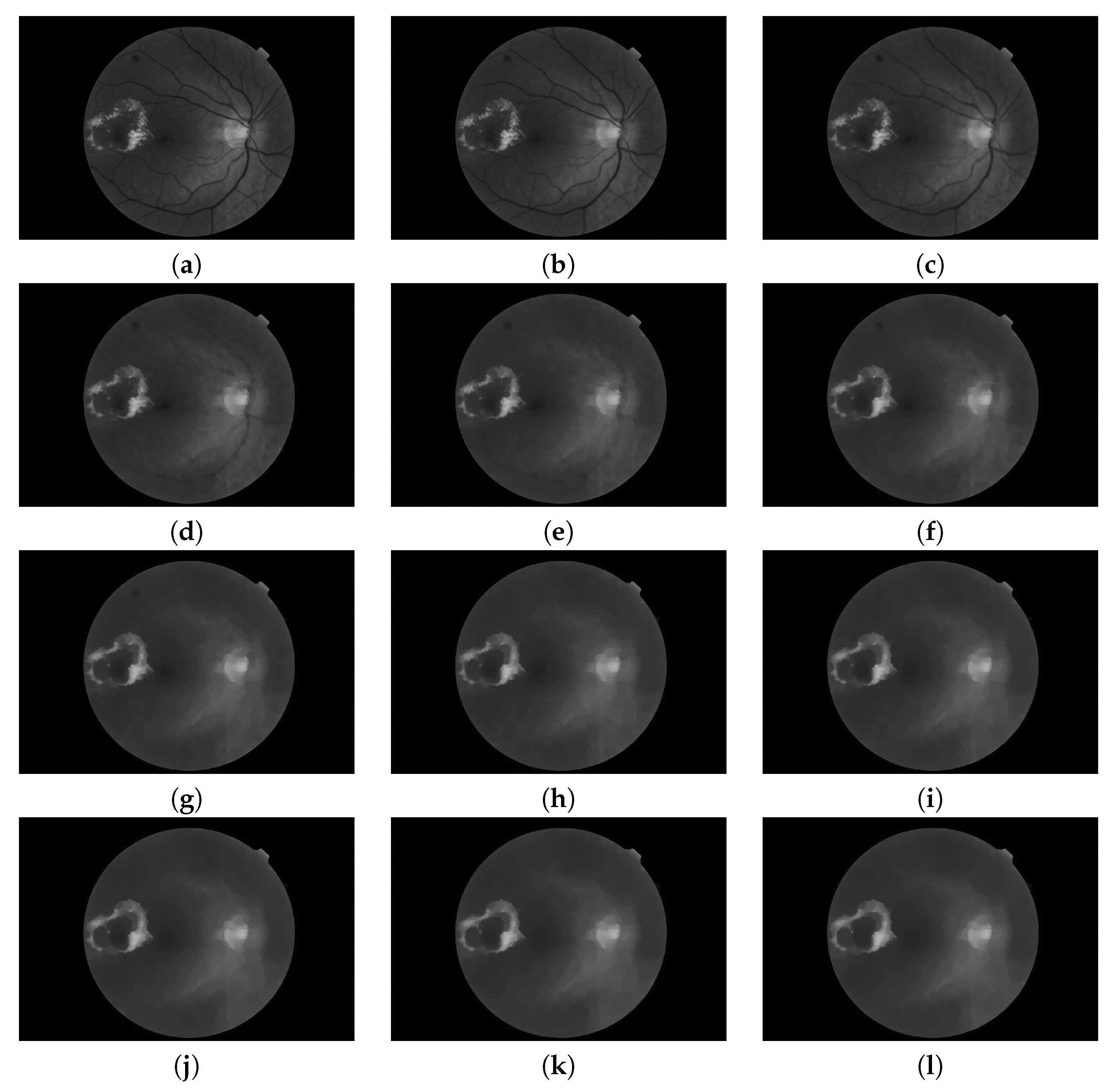 Sensors 20 01005 g006