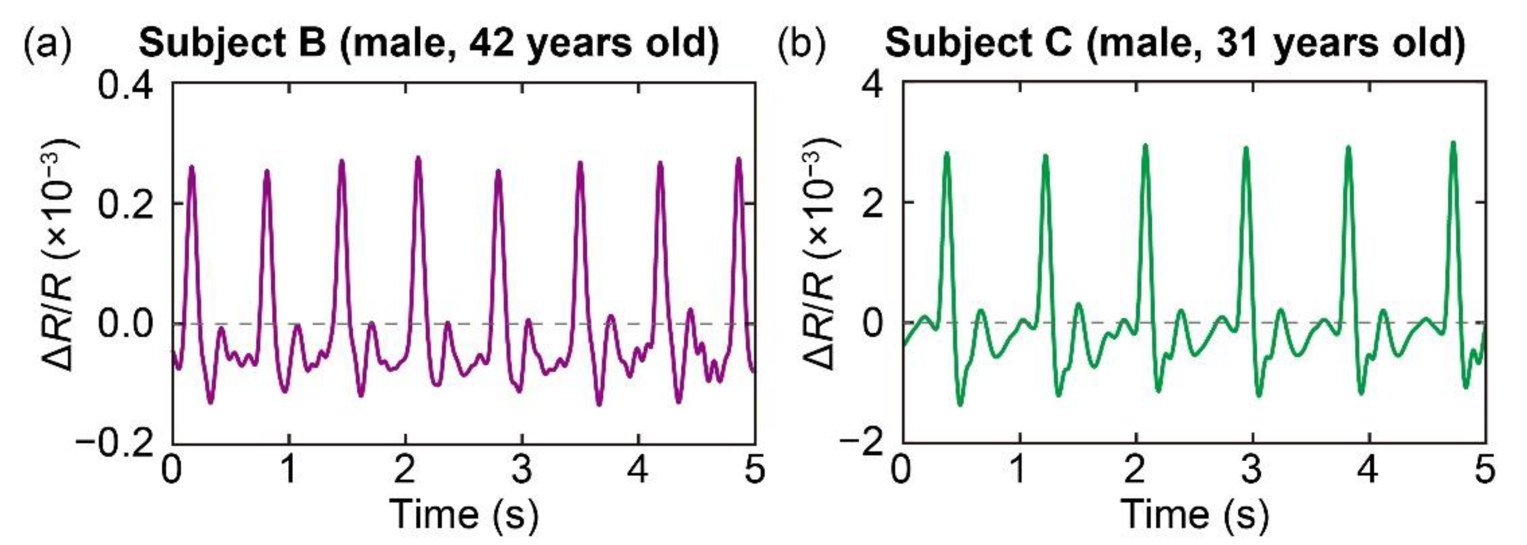 Sensors 20 01052 g005 Sensors 20 01052 g005