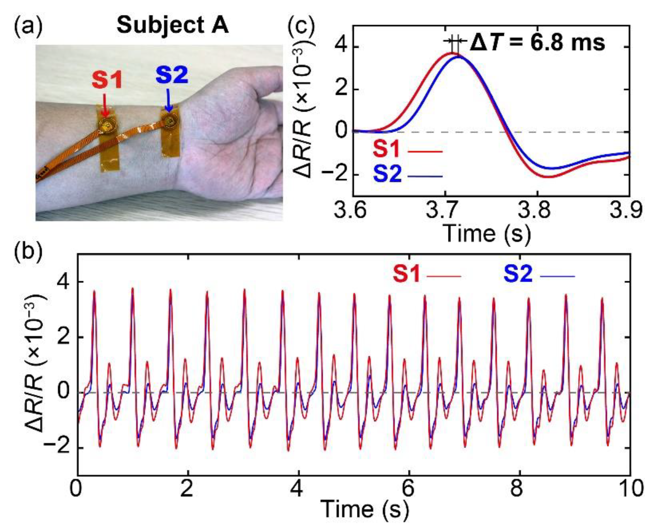 Sensors 20 01052 g006 Sensors 20 01052 g006