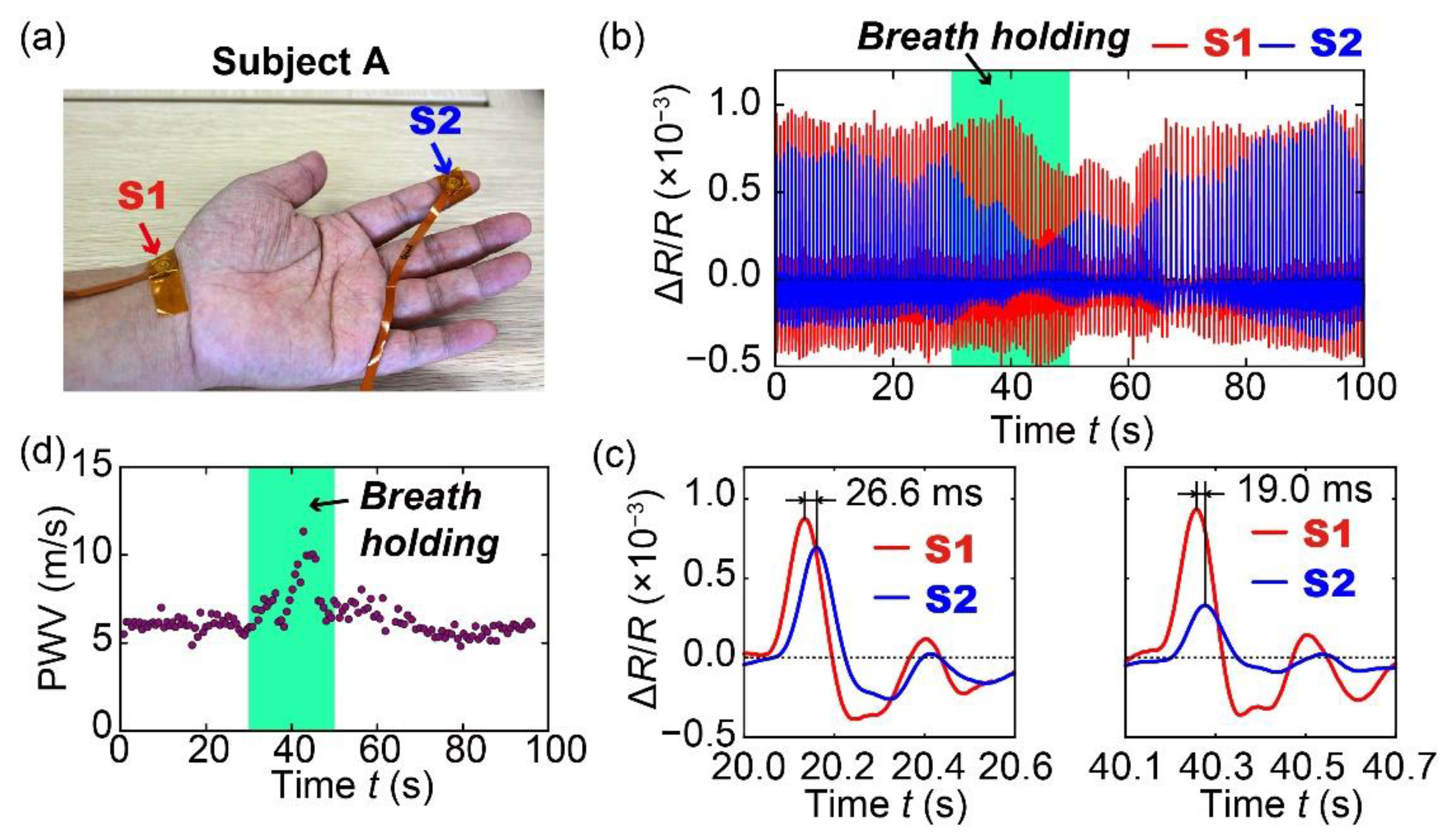 Sensors 20 01052 g007 Sensors 20 01052 g007