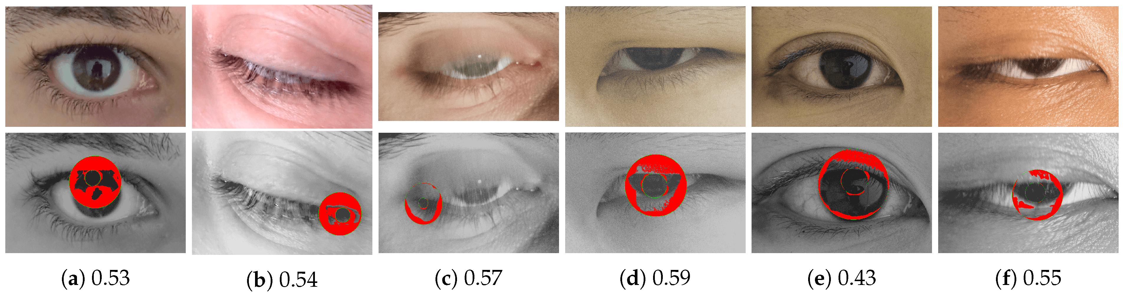 Sensors 20 01308 g011 Sensors 20 01308 g011