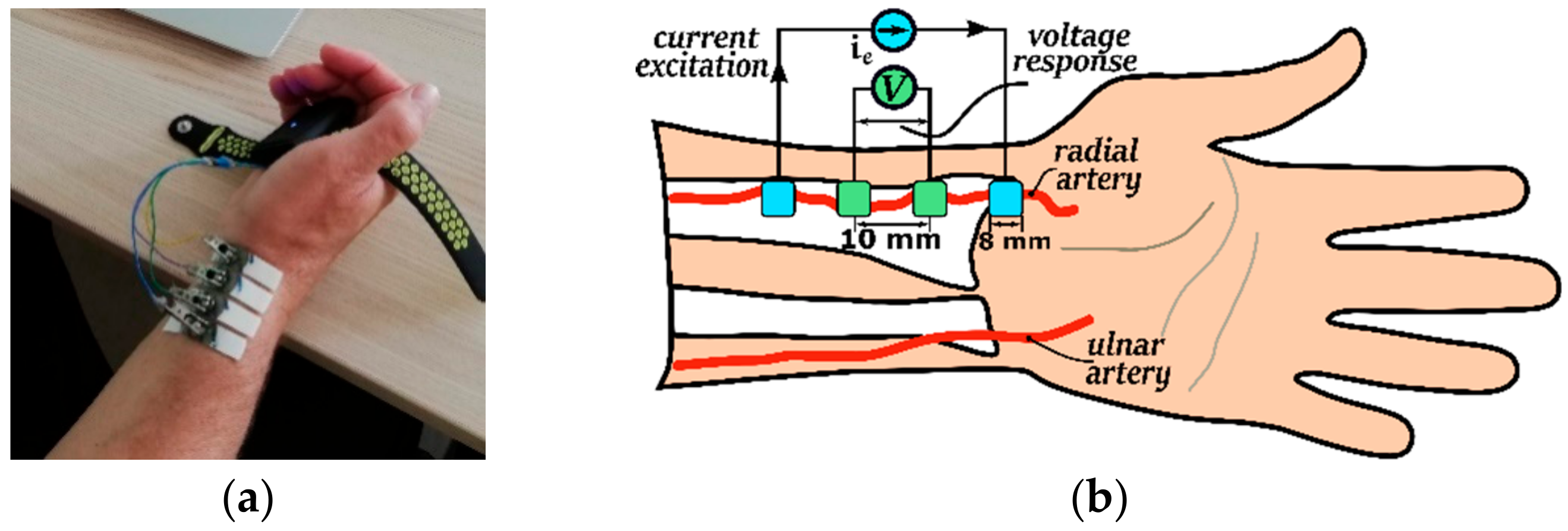 Sensors 20 01363 g002