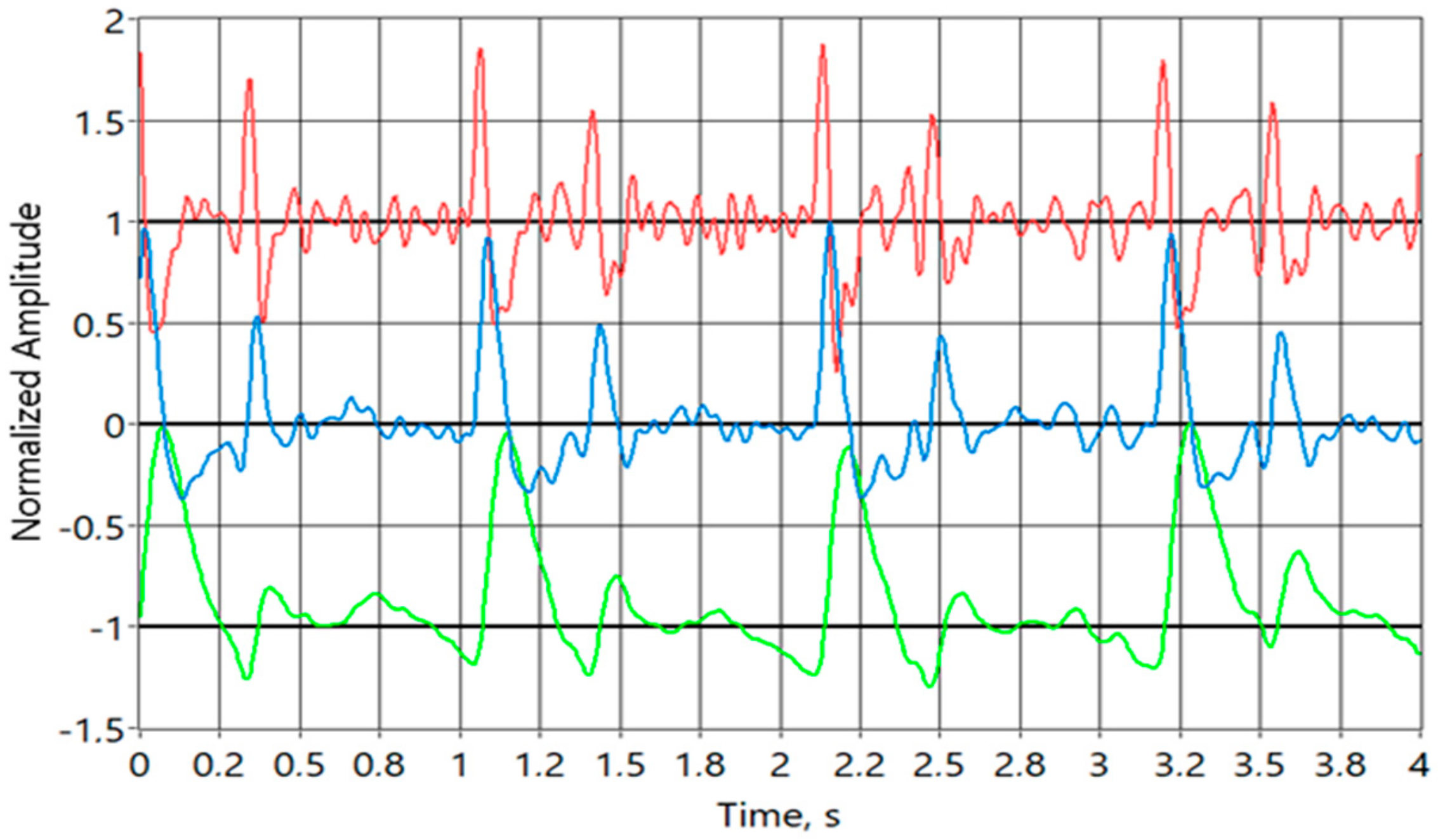 Sensors 20 01363 g015