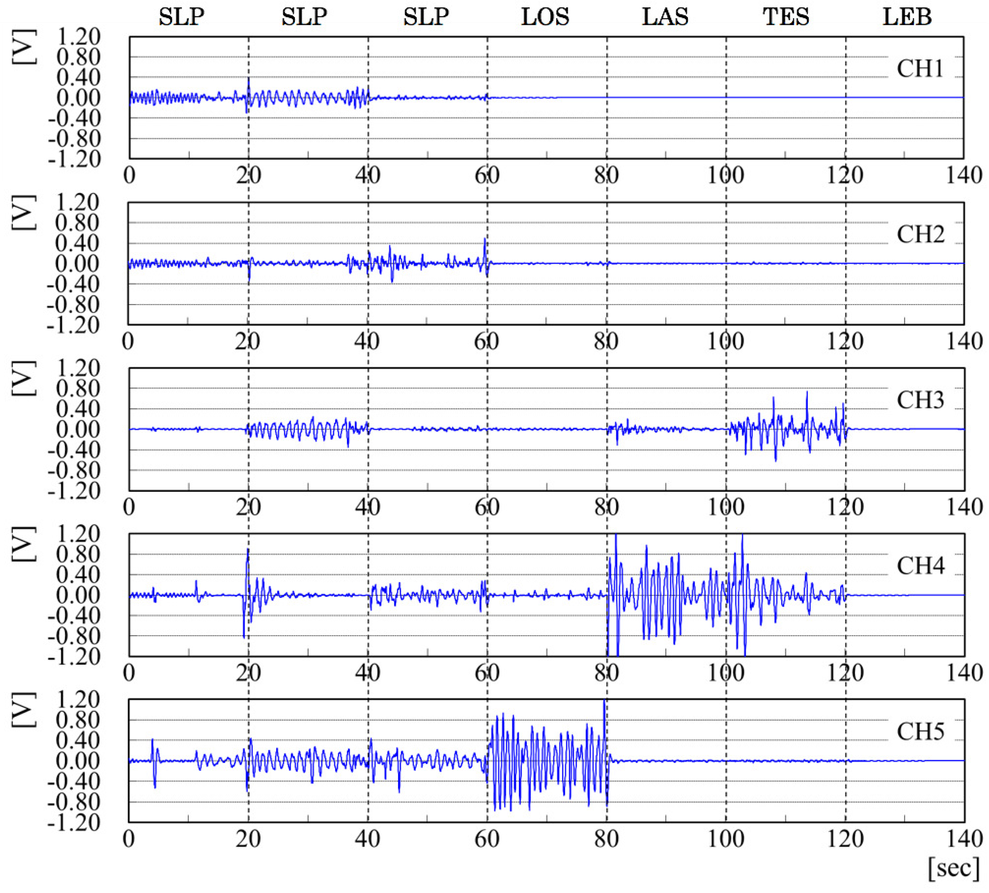 Sensors 20 01415 g013
