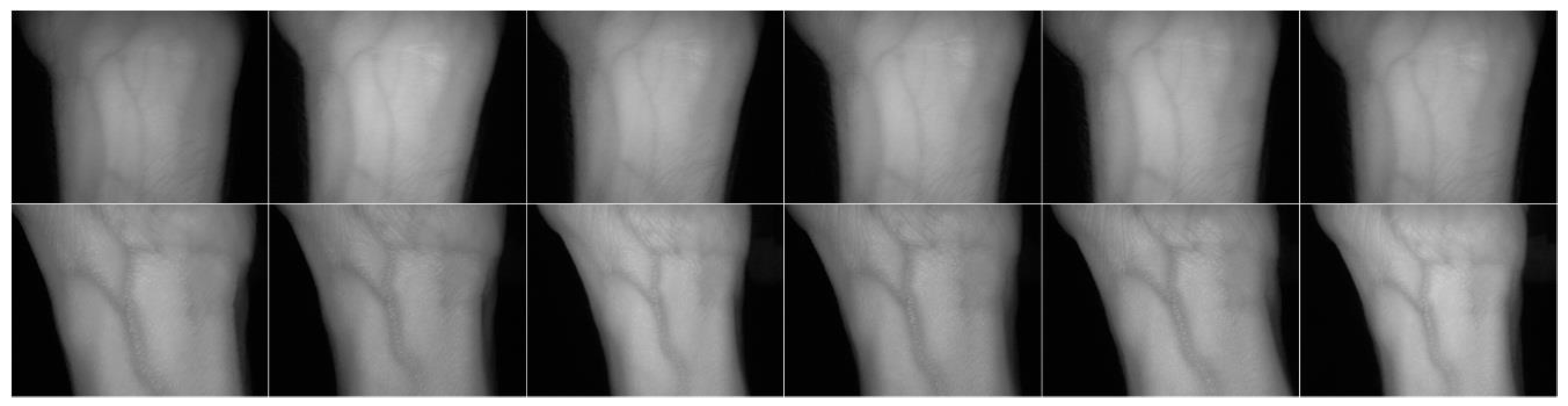 Sensors 20 01469 g011